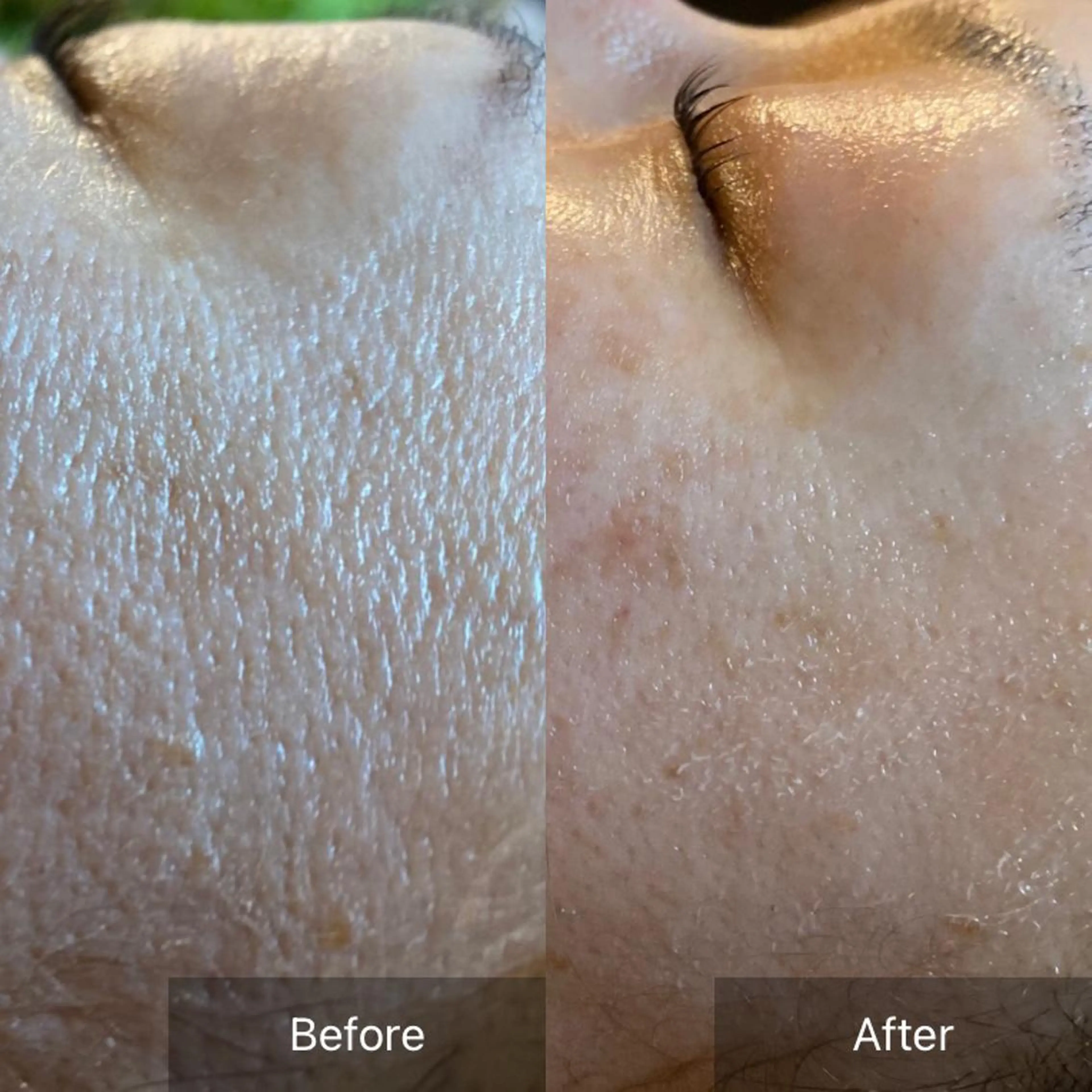 Mandarin Orange所属・毛穴から始める肌メン テマンダリンオレンジのエステ・リラクイメージ