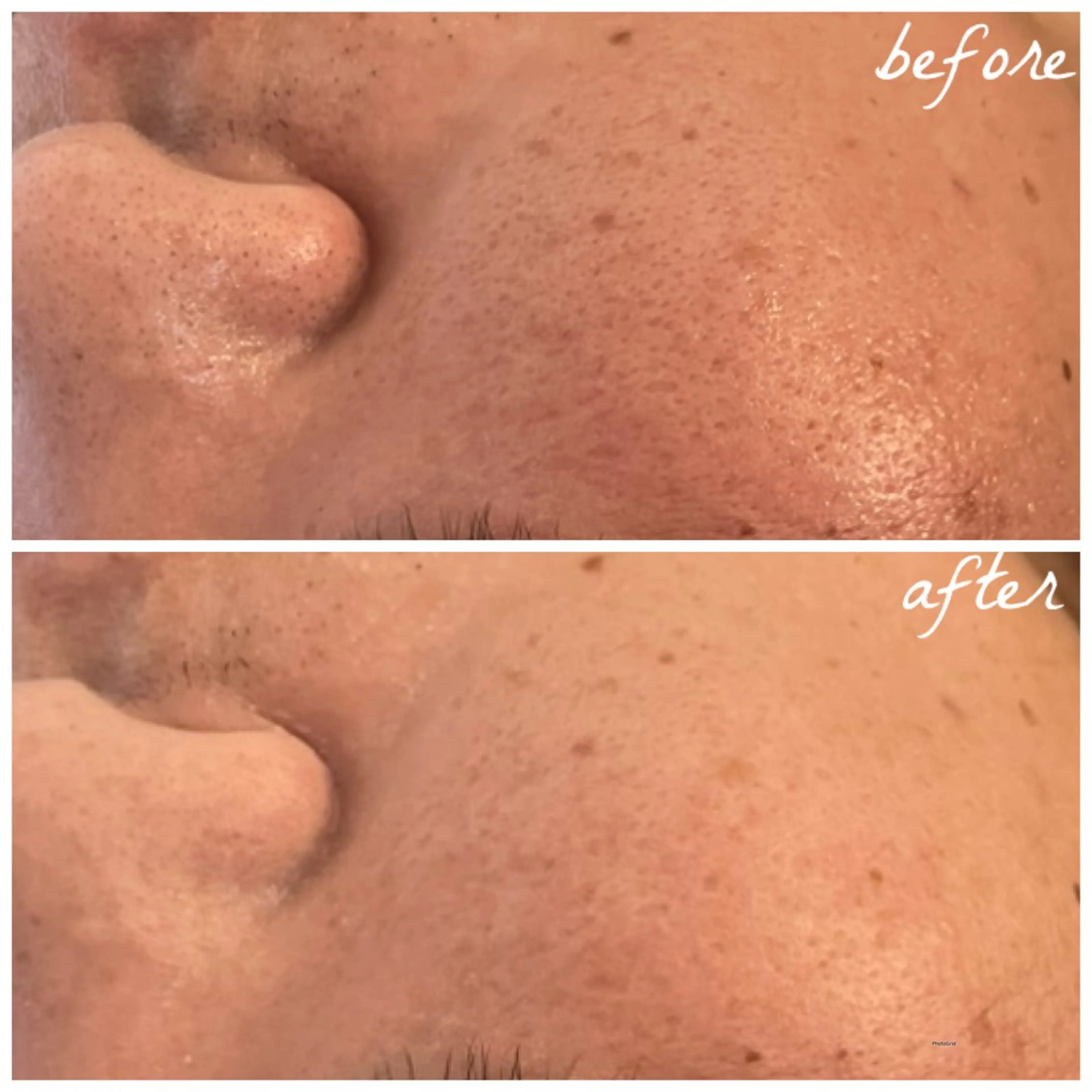 メンズ エステ メナード岐阜茜部 杉浦のエステ・リラクイメージ