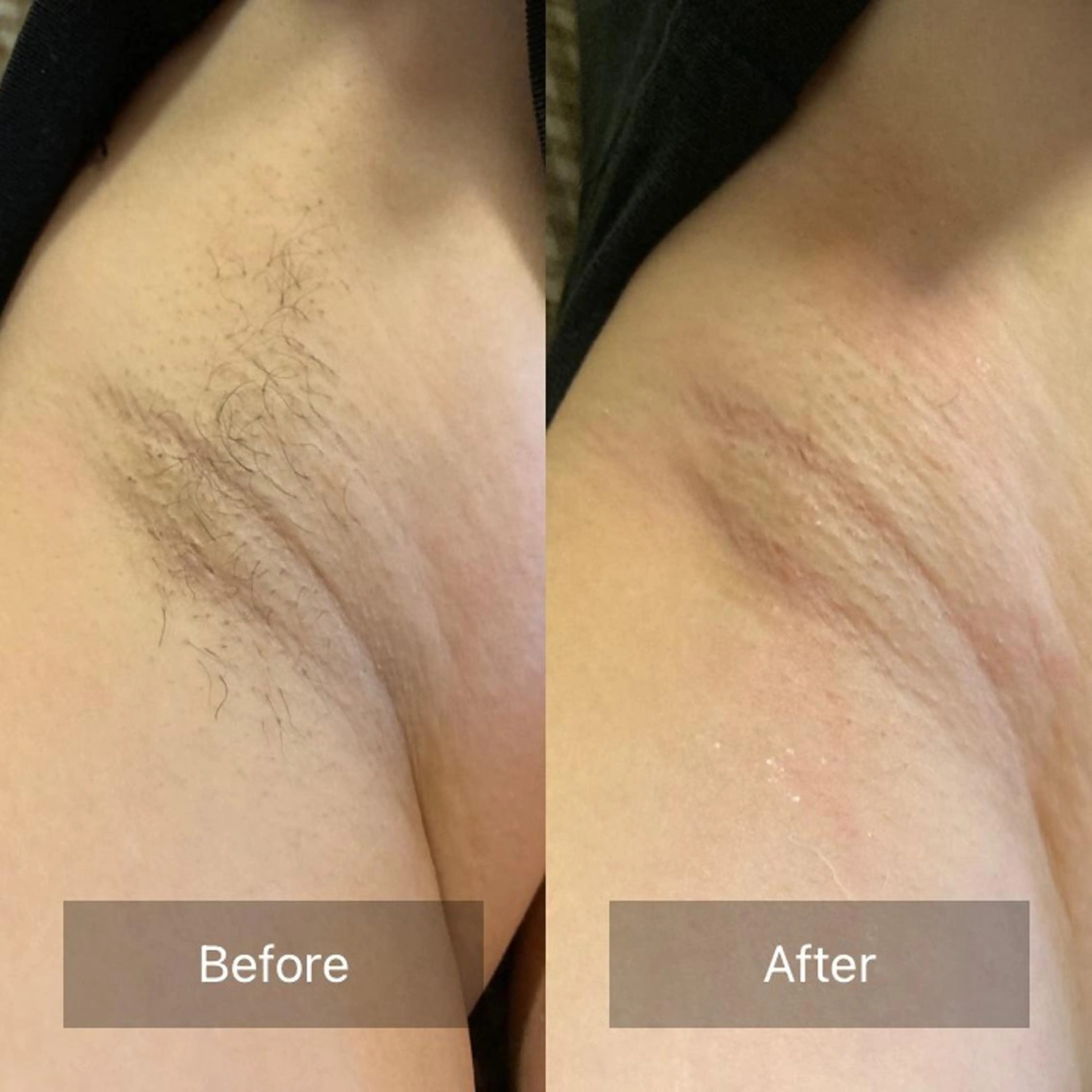 脱毛 産毛専門店 Bittoのエステ・リラクイメージ