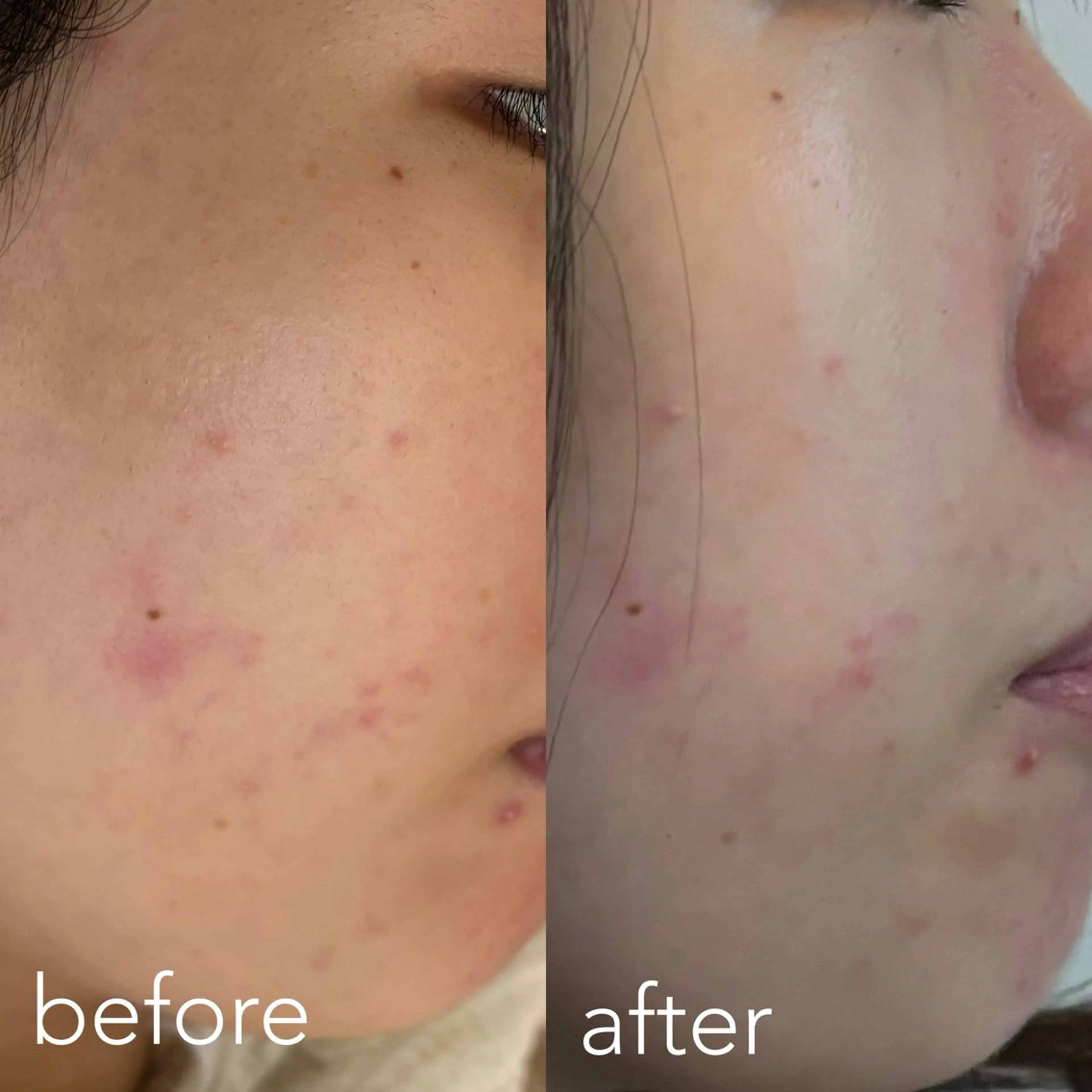 エステティックサロン Liente(リアンテ)所属・Hashimoto .のエステ・リラクイメージ