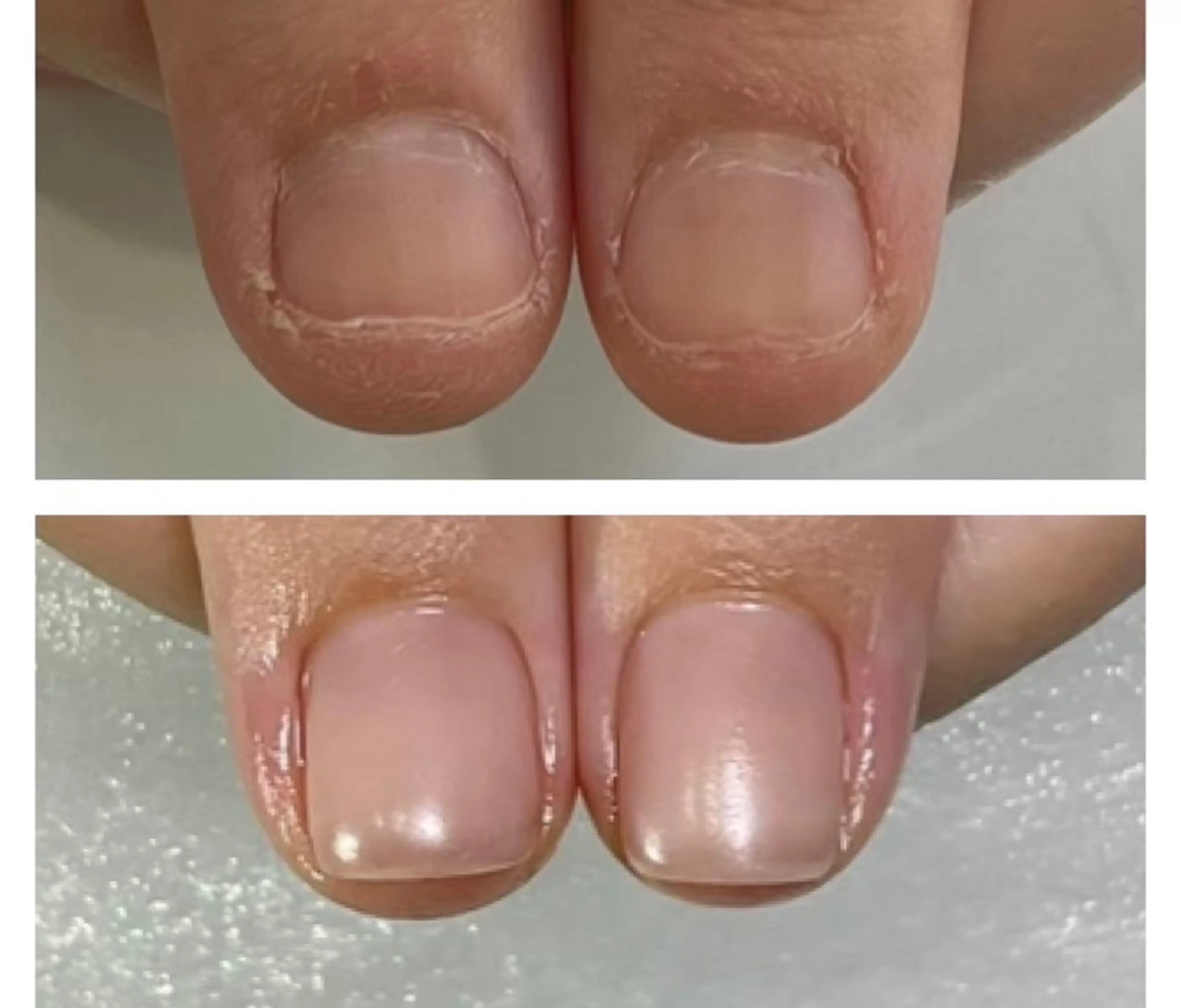 ネイル hana.nail 自爪育成サロンのネイルデザイン