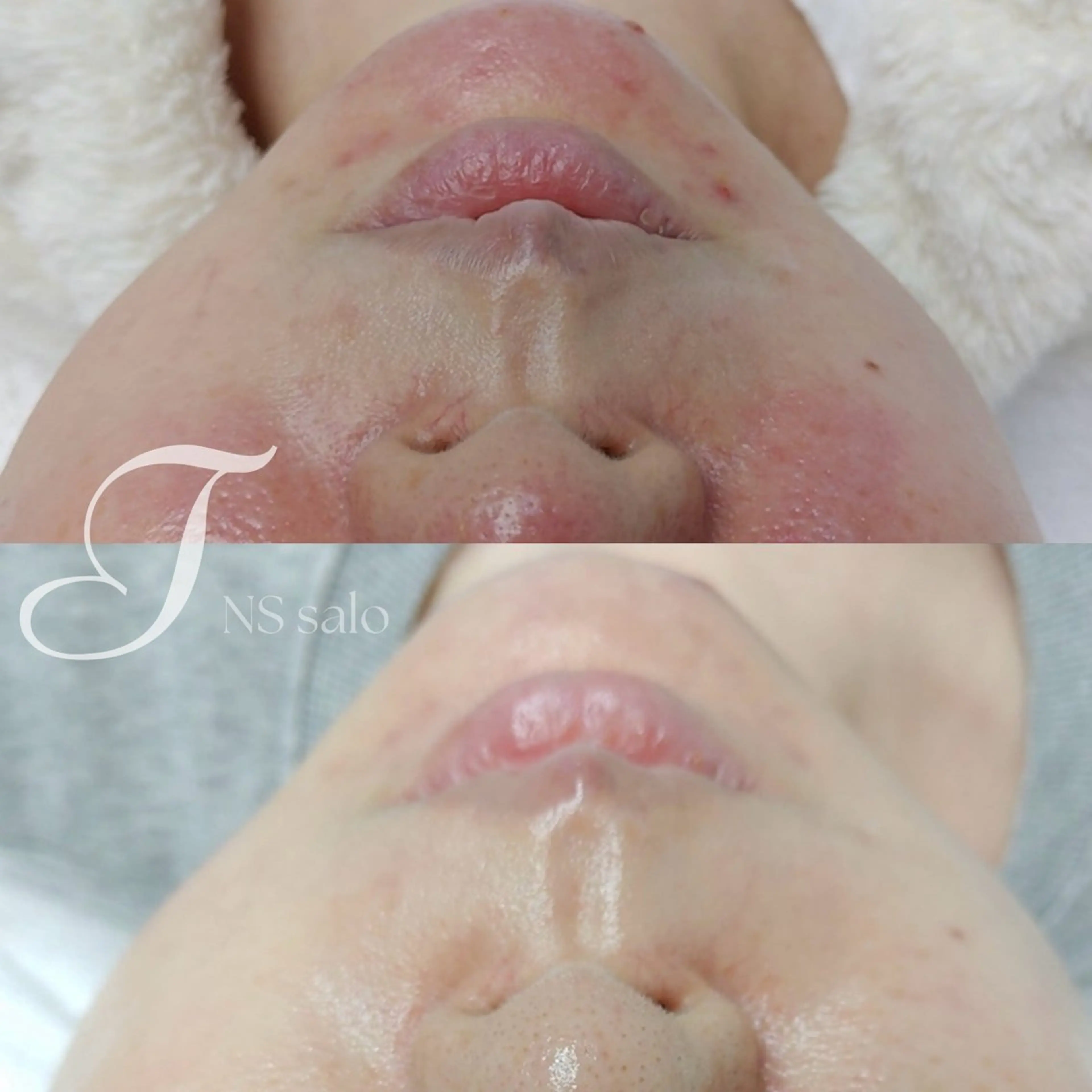 ナスサロ所属・💖韓国肌管理 :美容看護師/T🪽のエステ・リラクイメージ