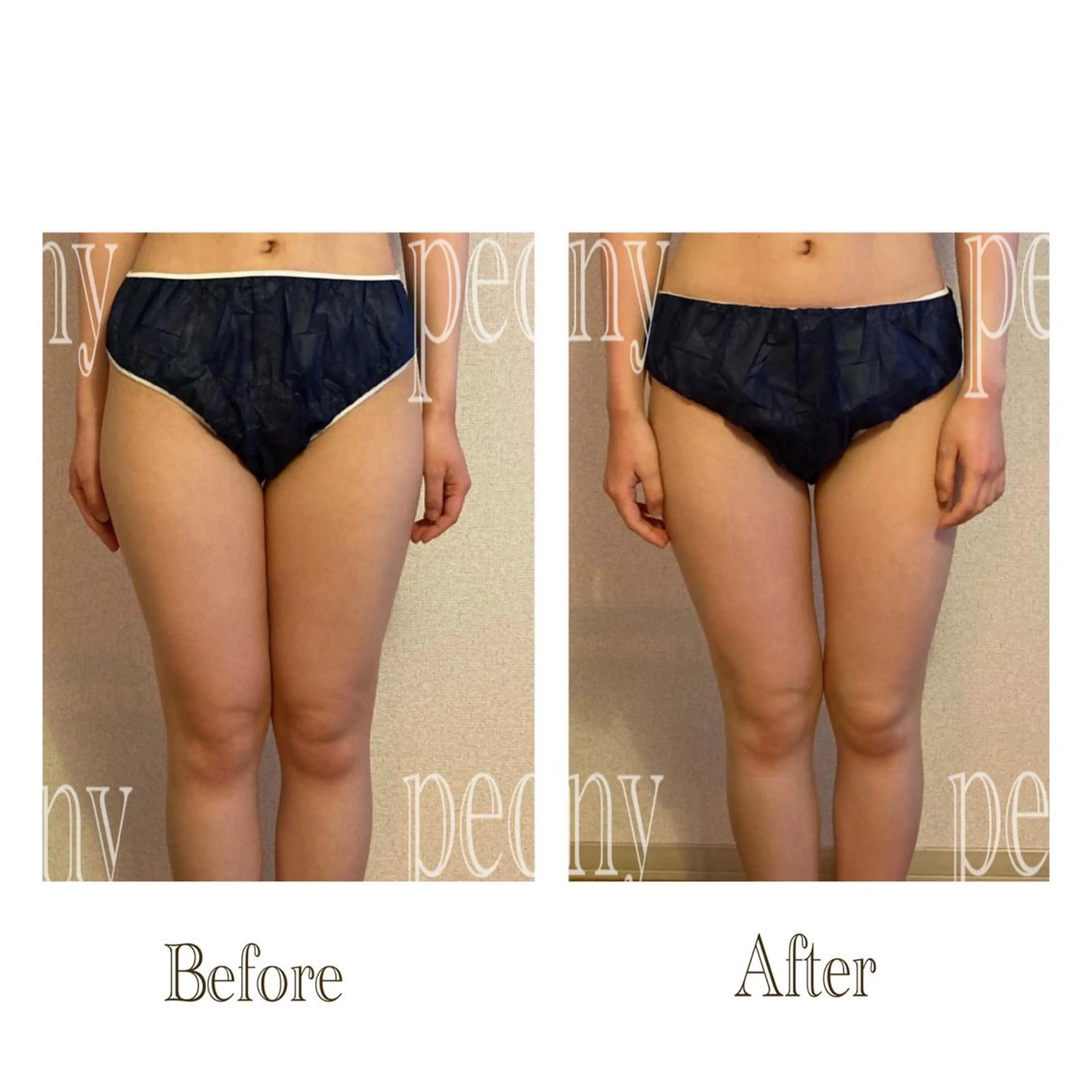 エステ デトックス美容専門サロンｐｅｏｎｙ所属・デトックス美容専門 サロンｐｅｏｎｙのエステ・リラクイメージ