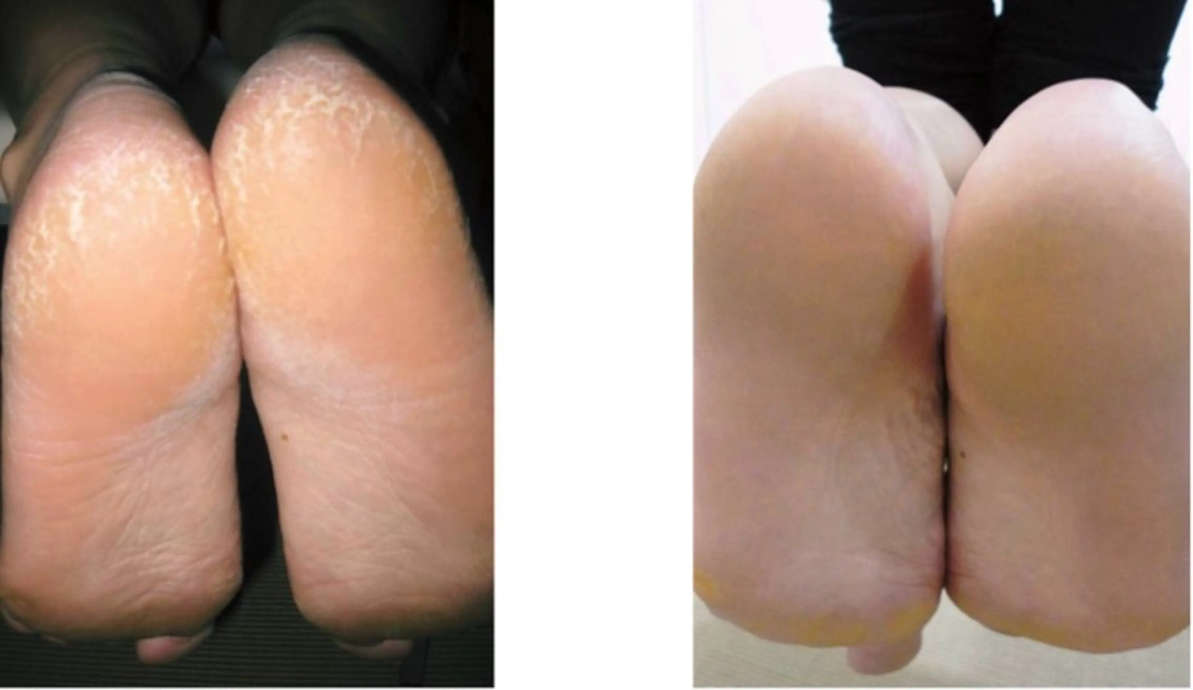 エステ リラク Lokahi所属・リラク/エステ Lokahiのエステ・リラクイメージ