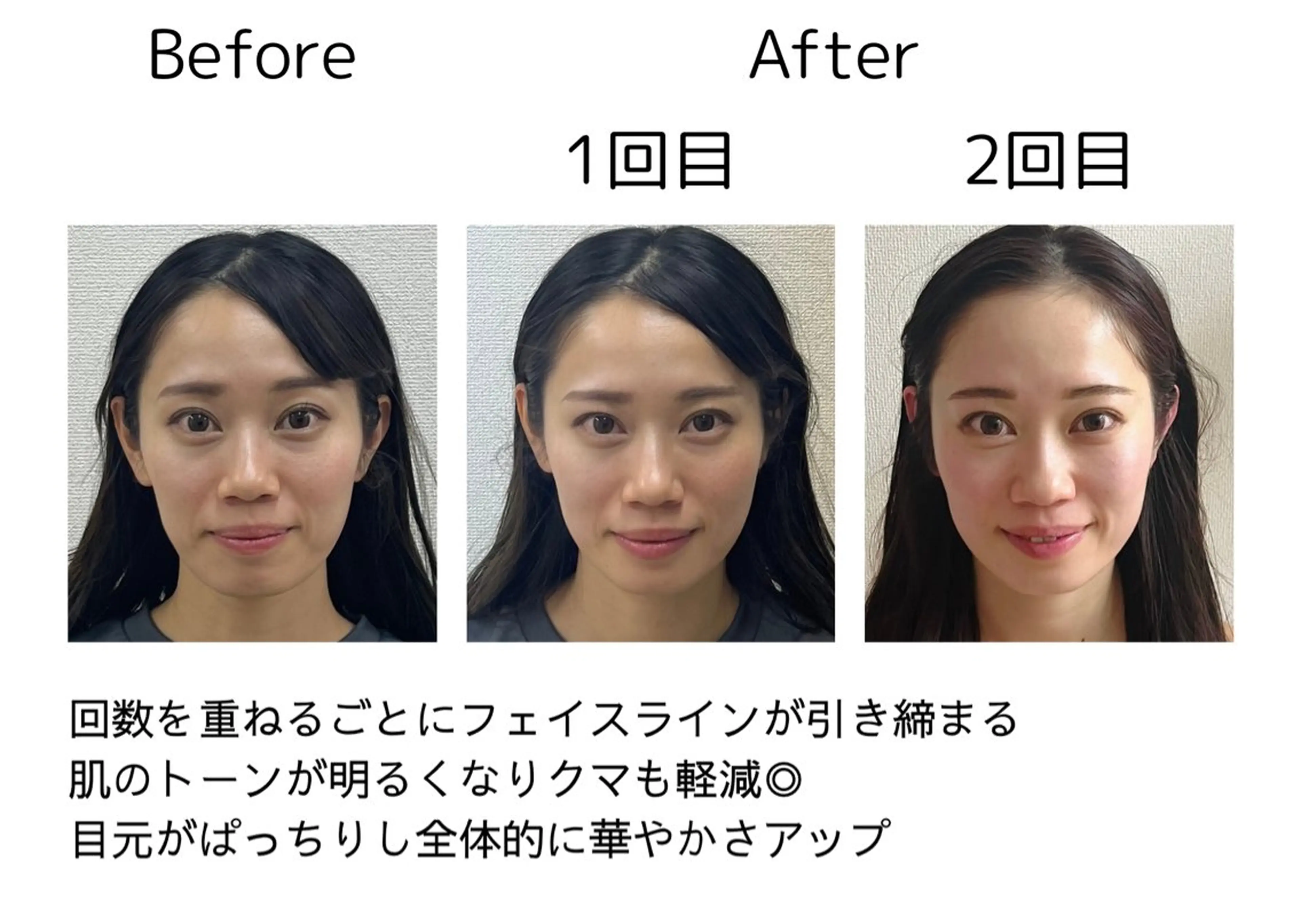 鍼灸院olina所属・鍼灸師 NARUMIのエステ・リラクイメージ