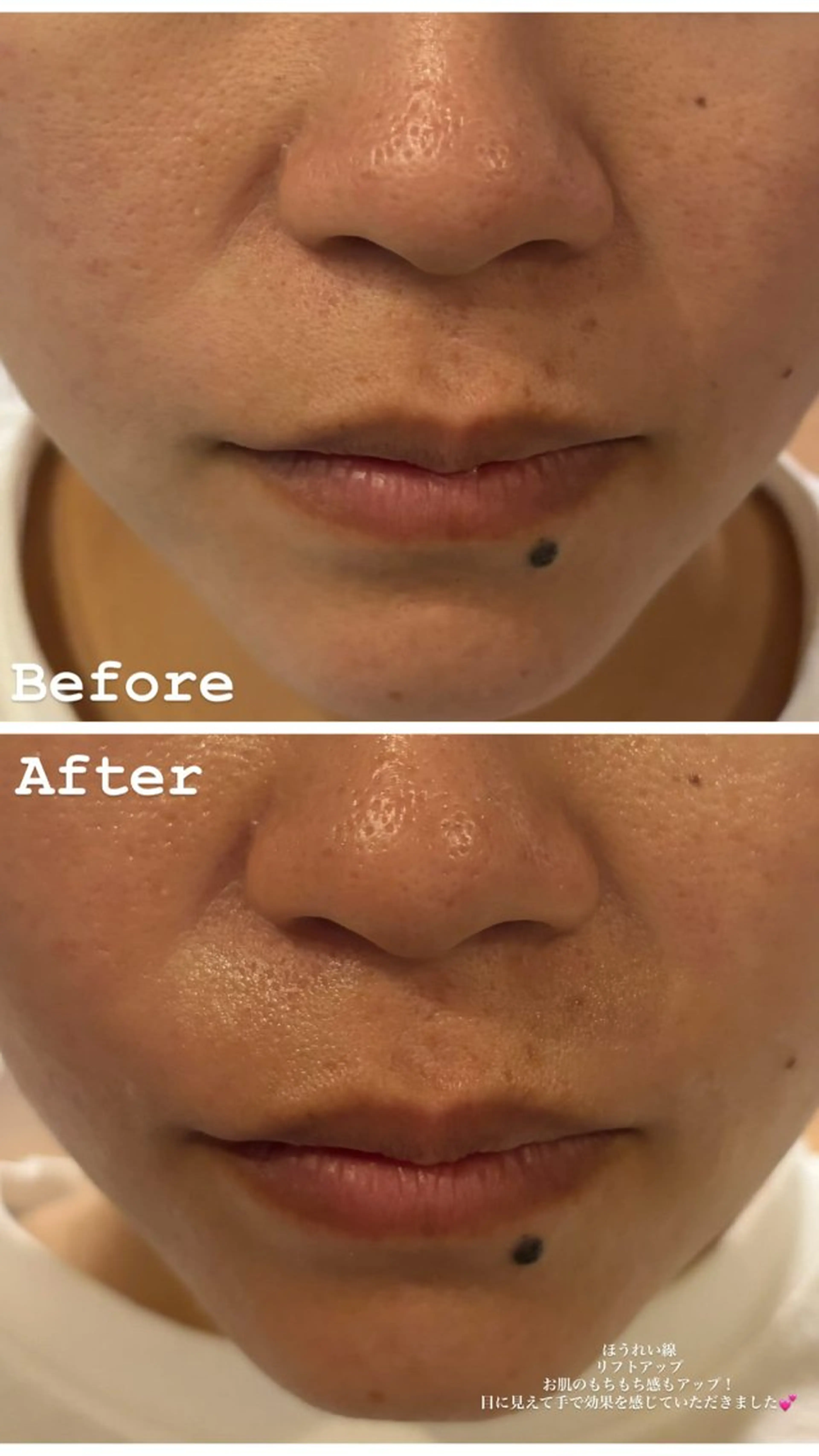 デ・アイム　西船橋所属・吉永玲奈 ニキビ/毛穴/シミのエステ・リラクイメージ