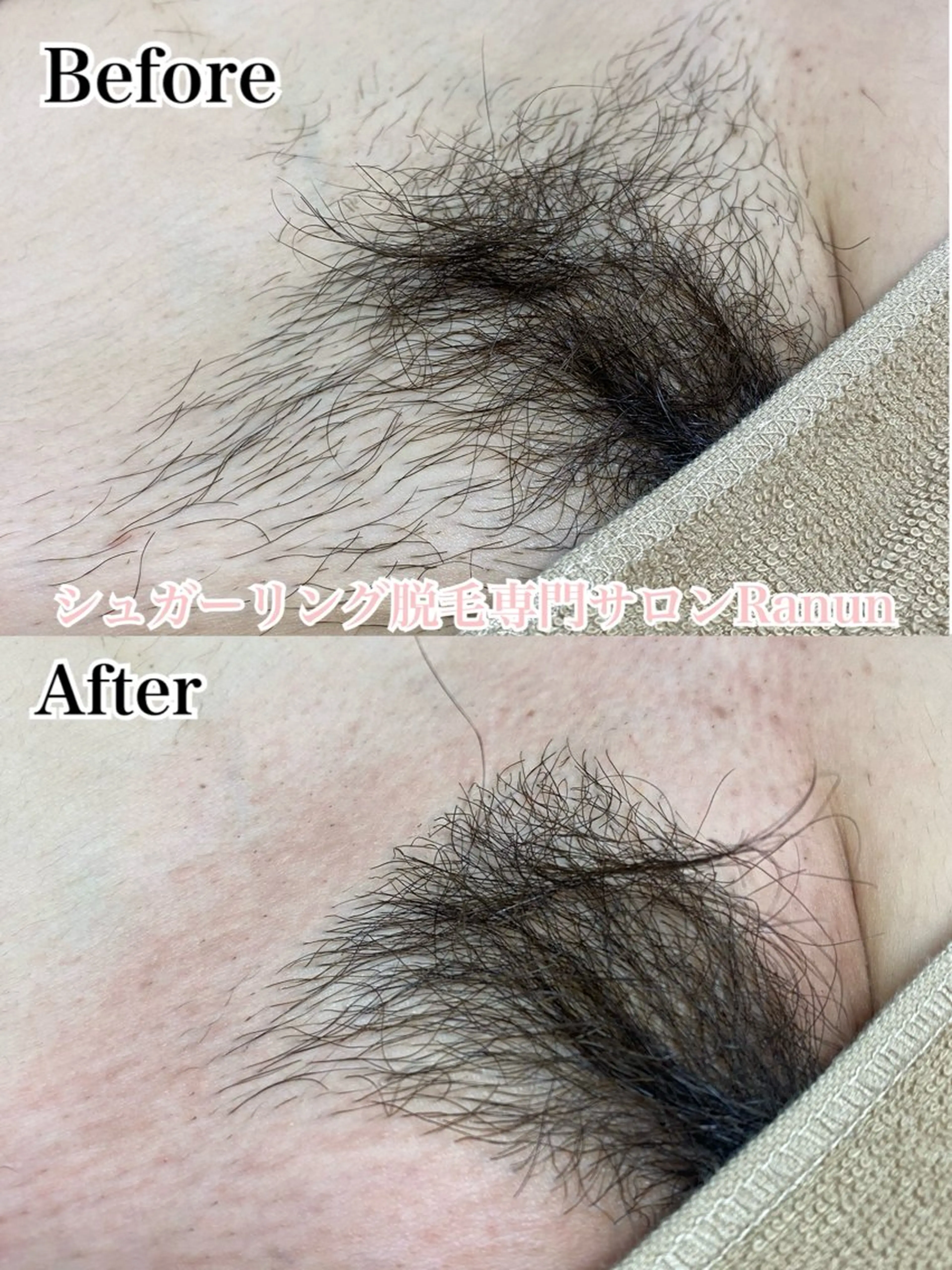 マツエク・マツパ シュガーリング脱毛 専門店Ranunのエステ・リラクイメージ