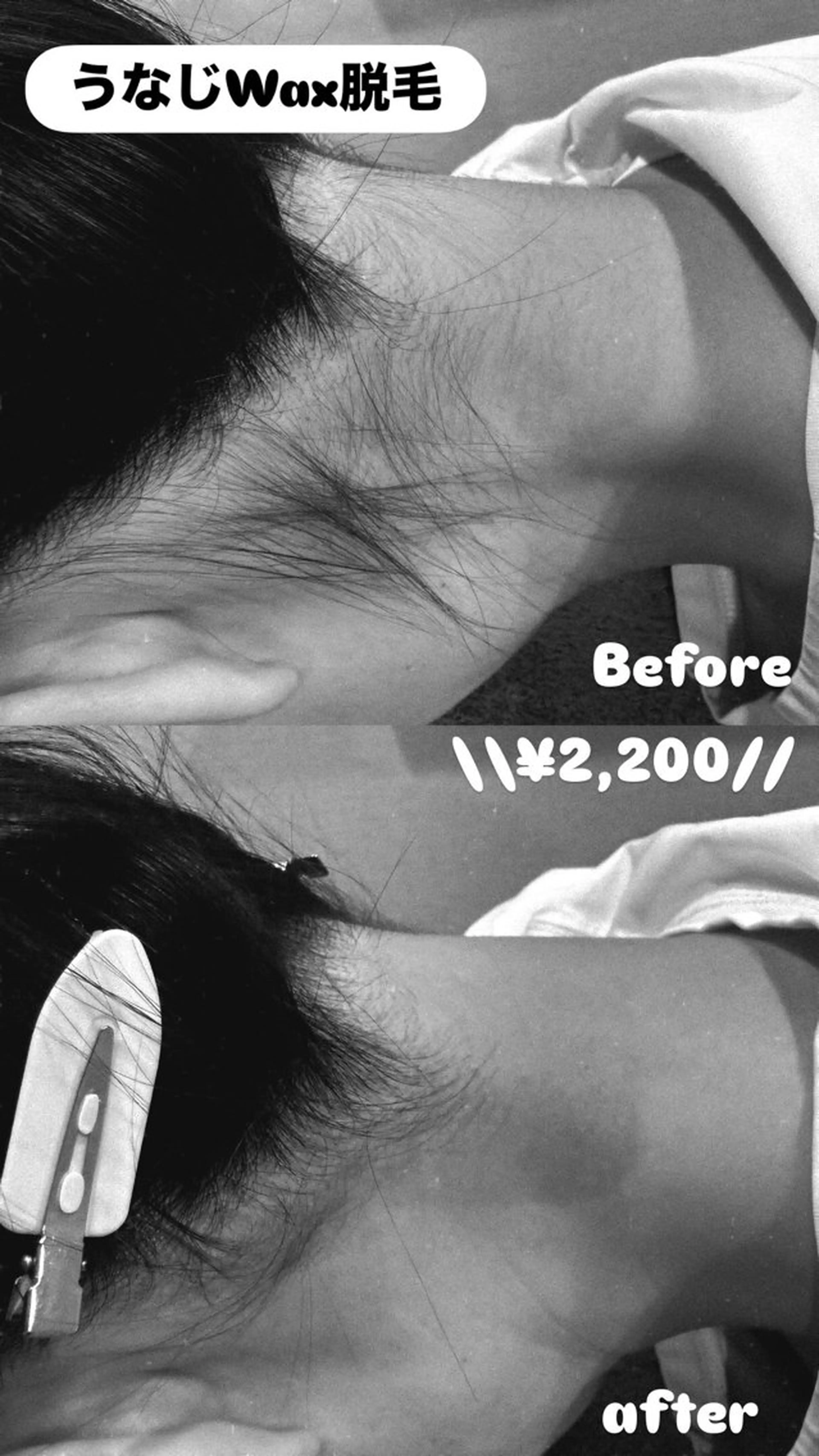 脱毛 LiZA エステティックサロンのその他イメージ