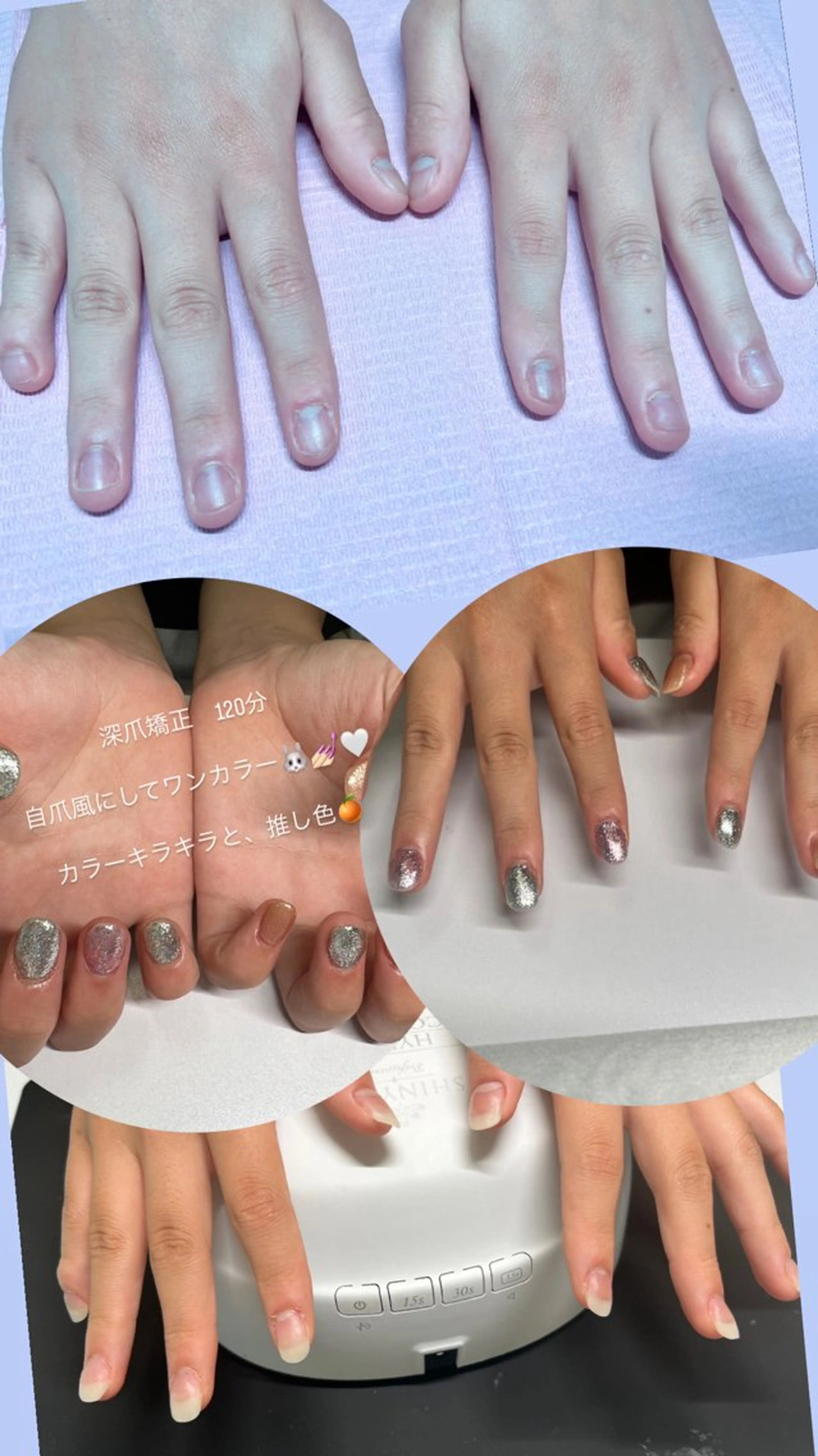 メンズ ネイル 爪ケア/深爪 自爪育成 🐰えむのネイルデザイン