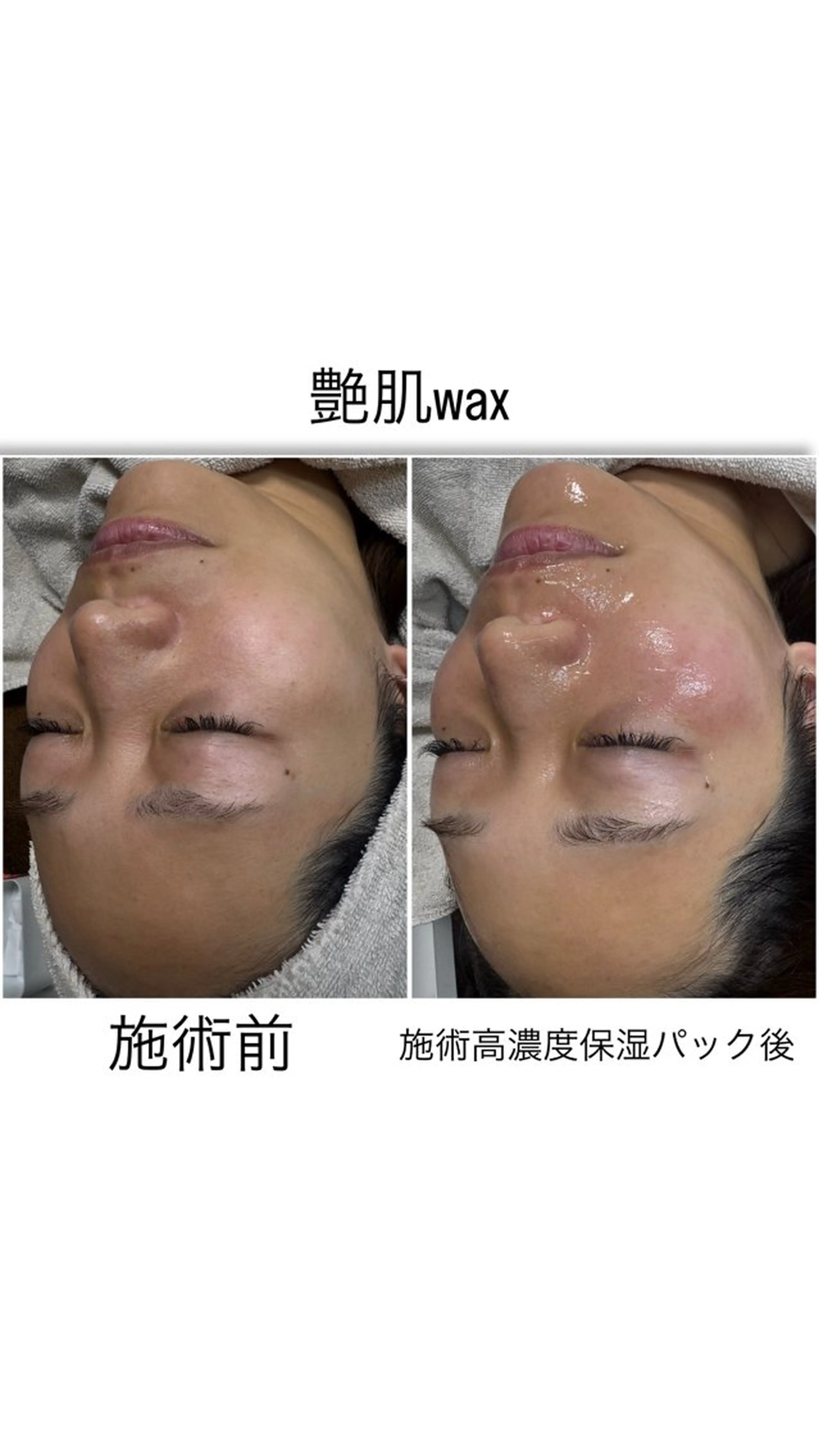 エステ yuuri. Sの眉毛・アイブロウイメージ