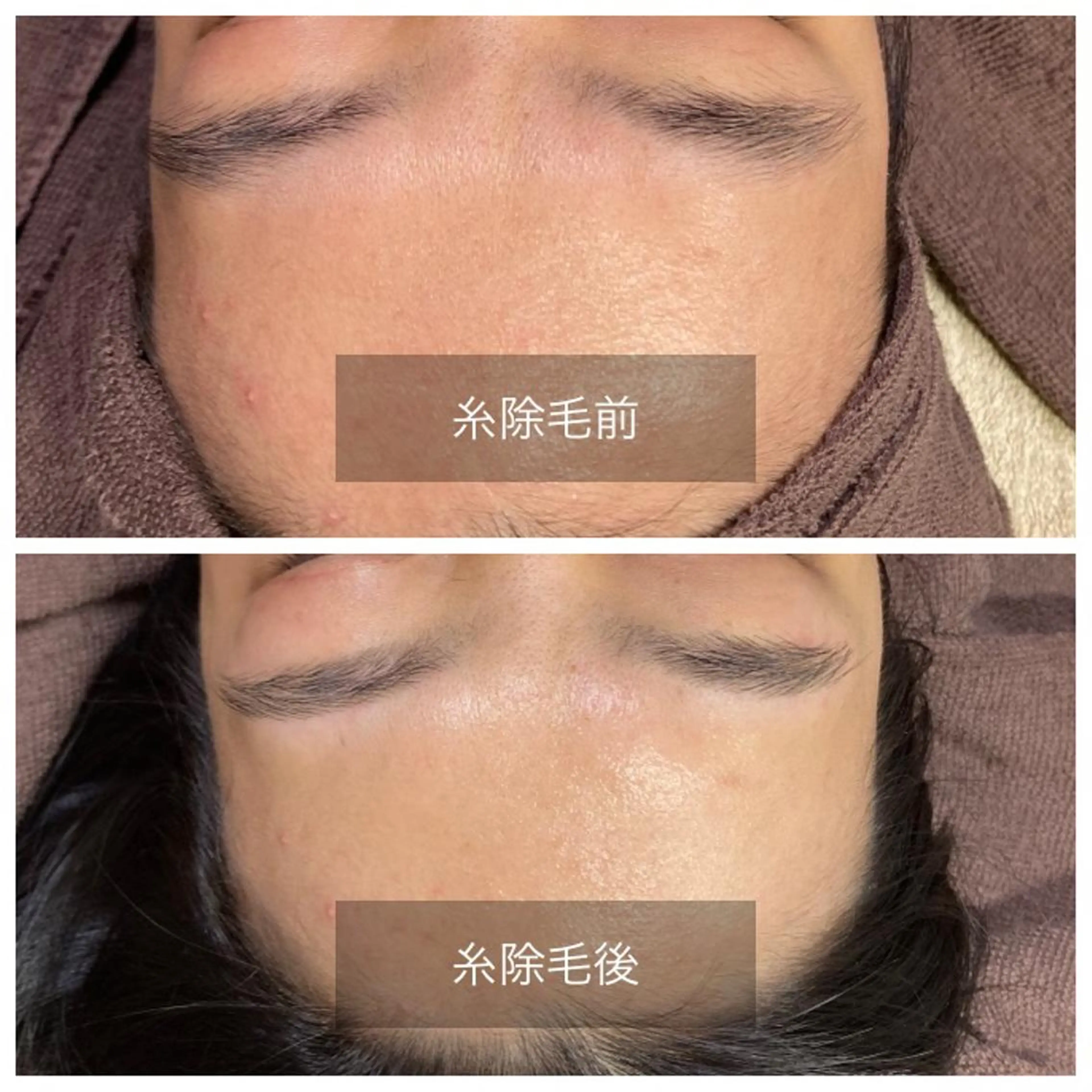 エステ 産毛専門店 Bittoのエステ・リラクイメージ