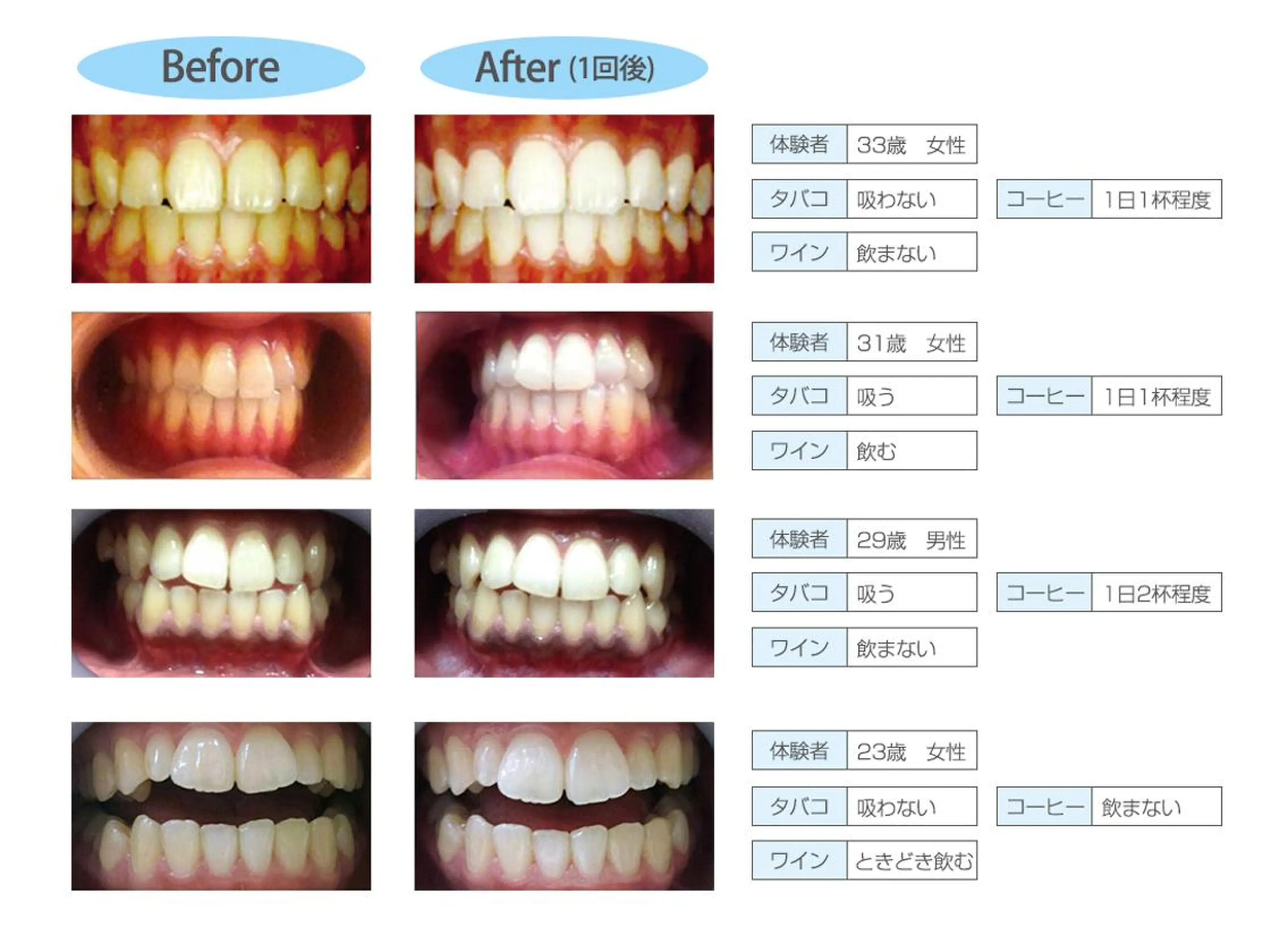 セルフホワイトニング 松原のエステ・リラクイメージ