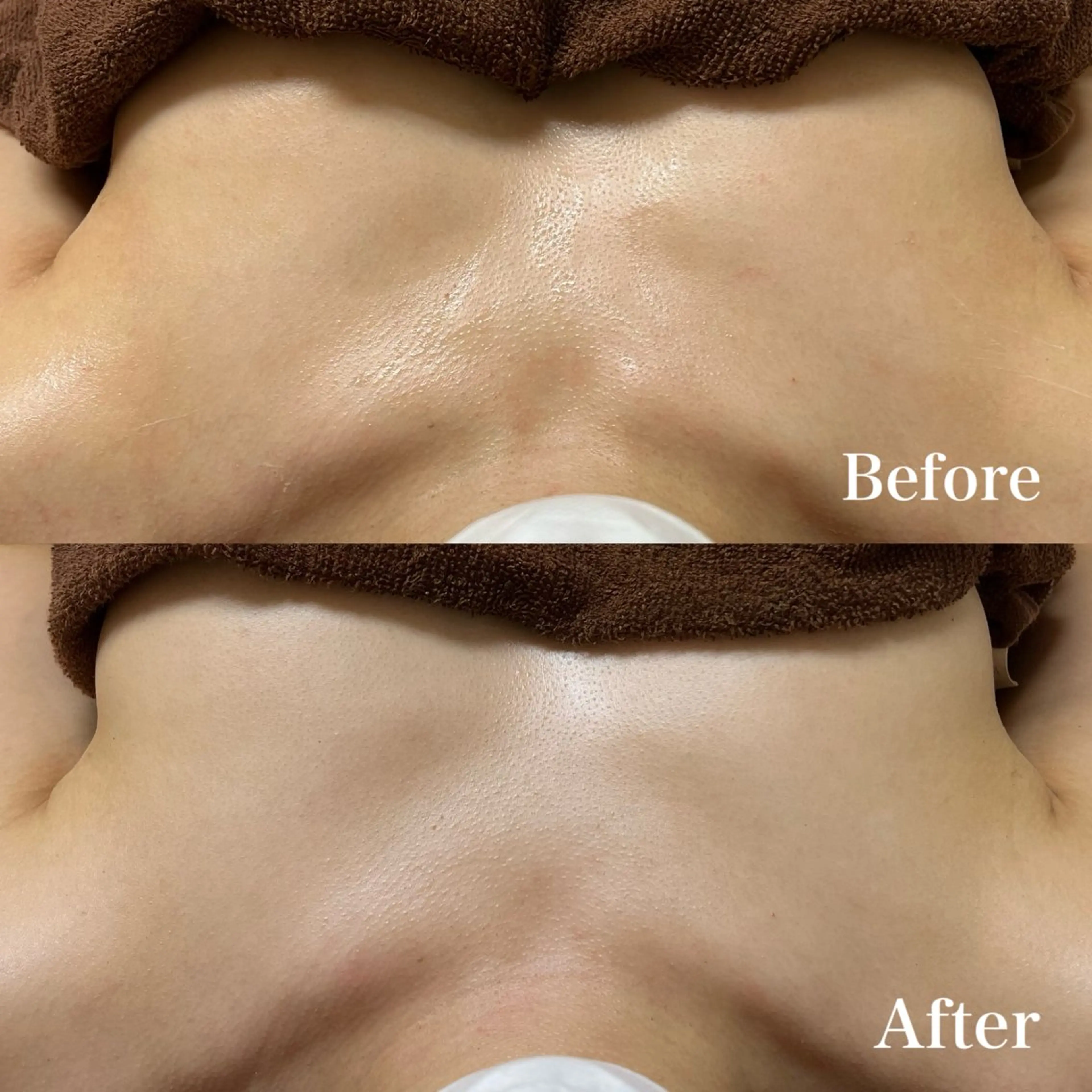 エステ 𝐌𝐚𝐜𝐡𝐞 𝐛𝐲 𝐌𝐚𝐲𝐮所属・ハーブピーリング🌿 𝑴𝒂𝒚𝒖のエステ・リラクイメージ