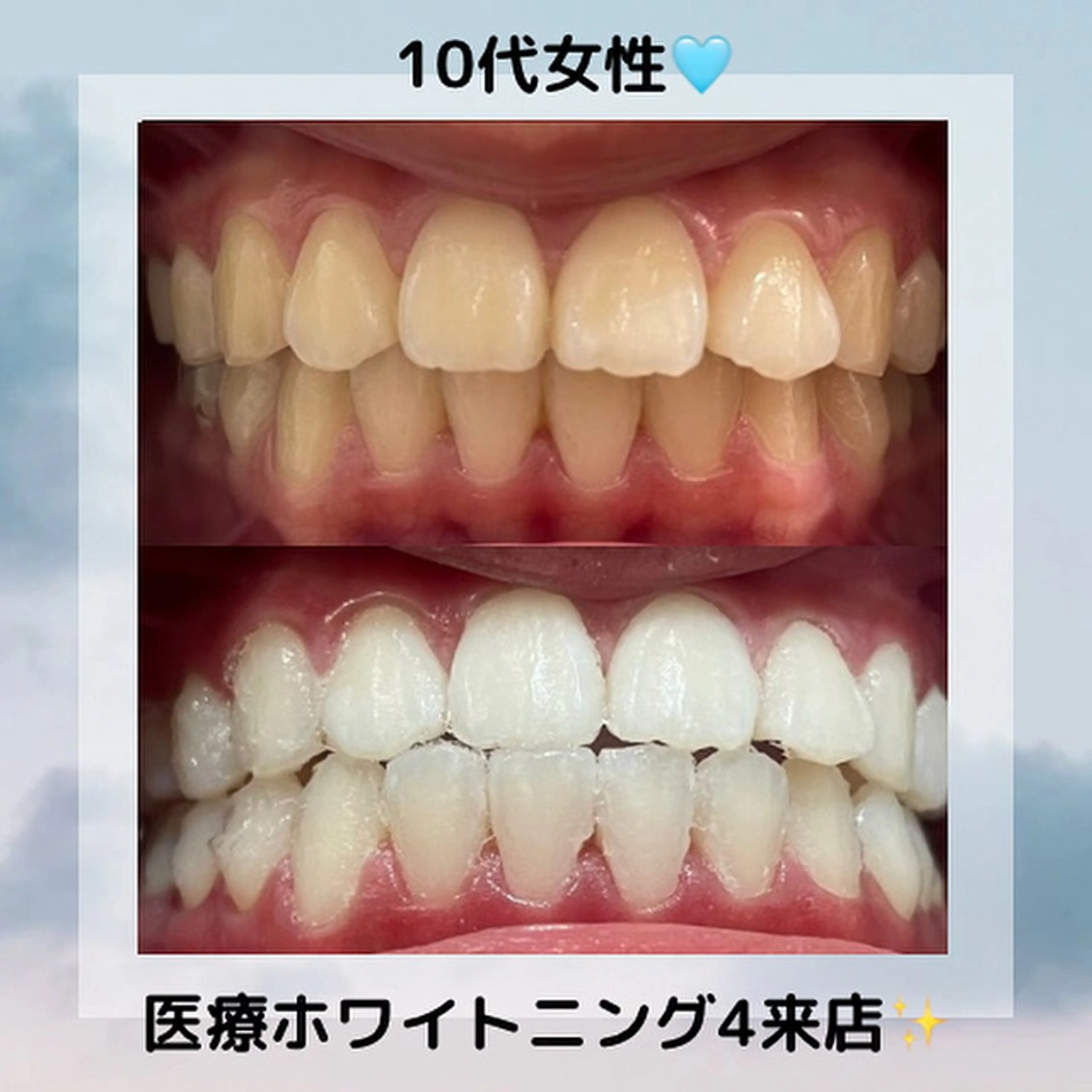 Kaula所属・Kaula ホワイトニング耳ツボのその他イメージ