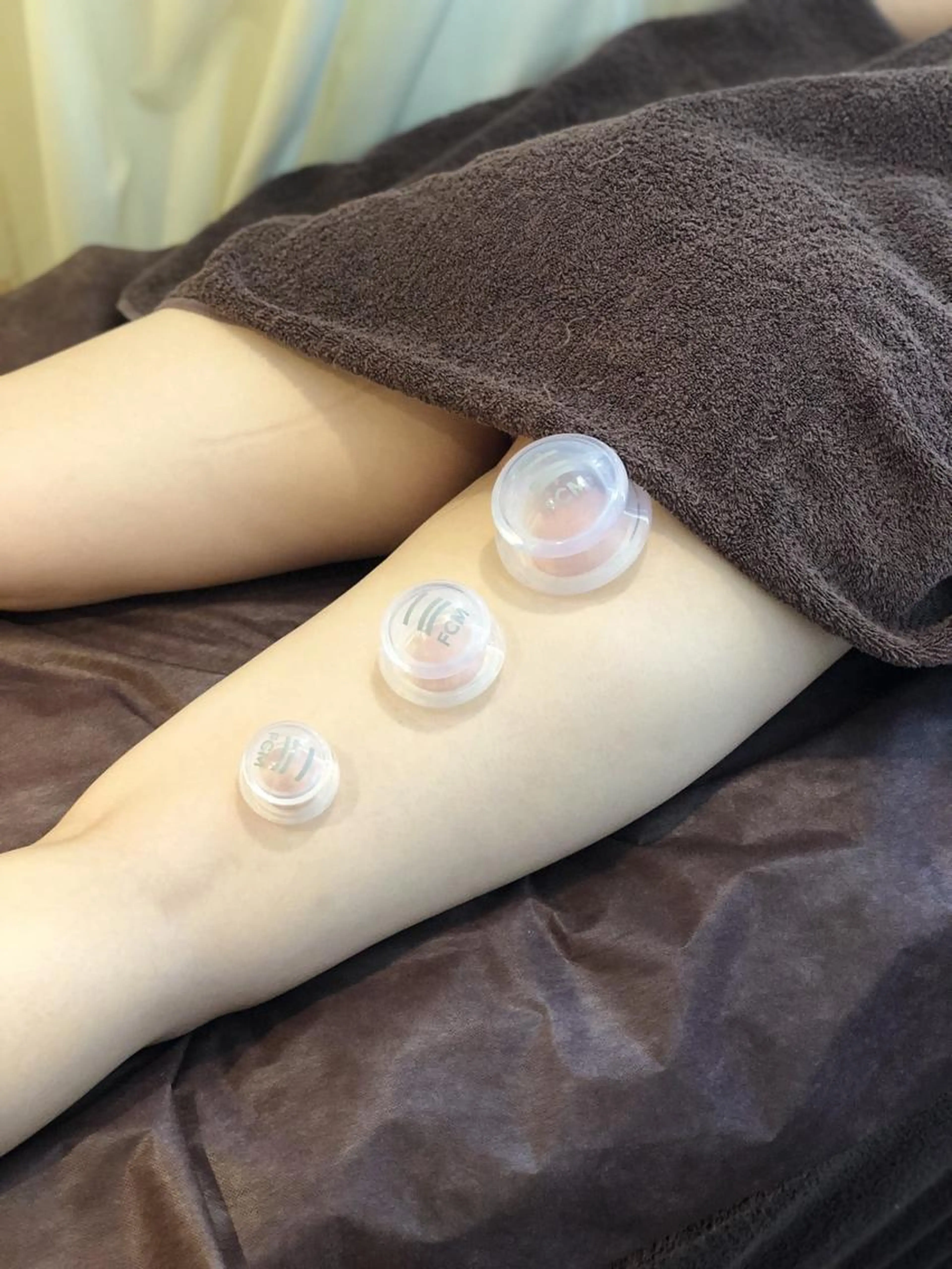 【美脚&美尻☆天使の羽】🪽筋膜リリース　スライドカッピング✨肩甲骨はがし  30分/¥3900の写真