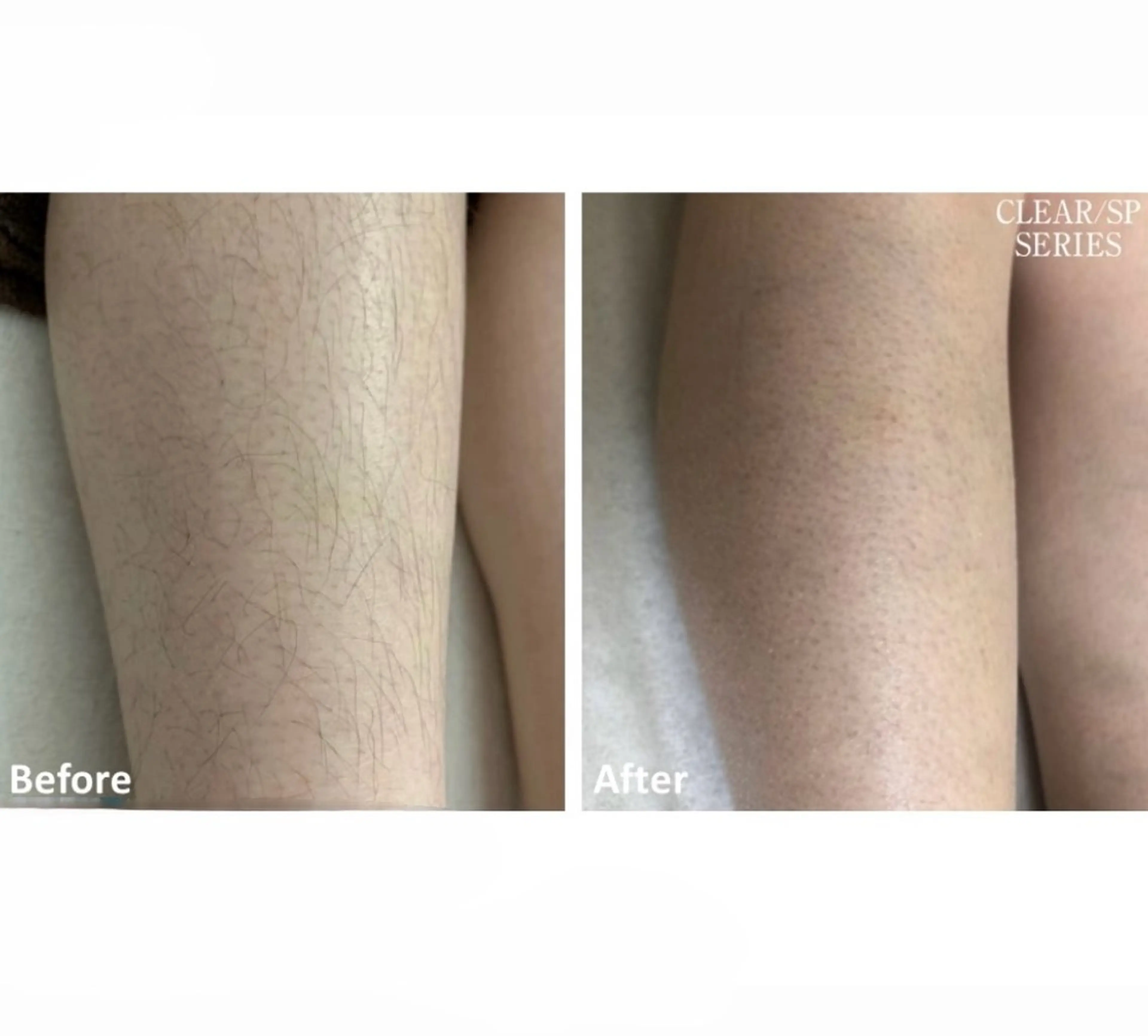 脱毛サロン ニカ所属・☀️脱毛・美容矯正 サロン ニカ☀️のエステ・リラクイメージ