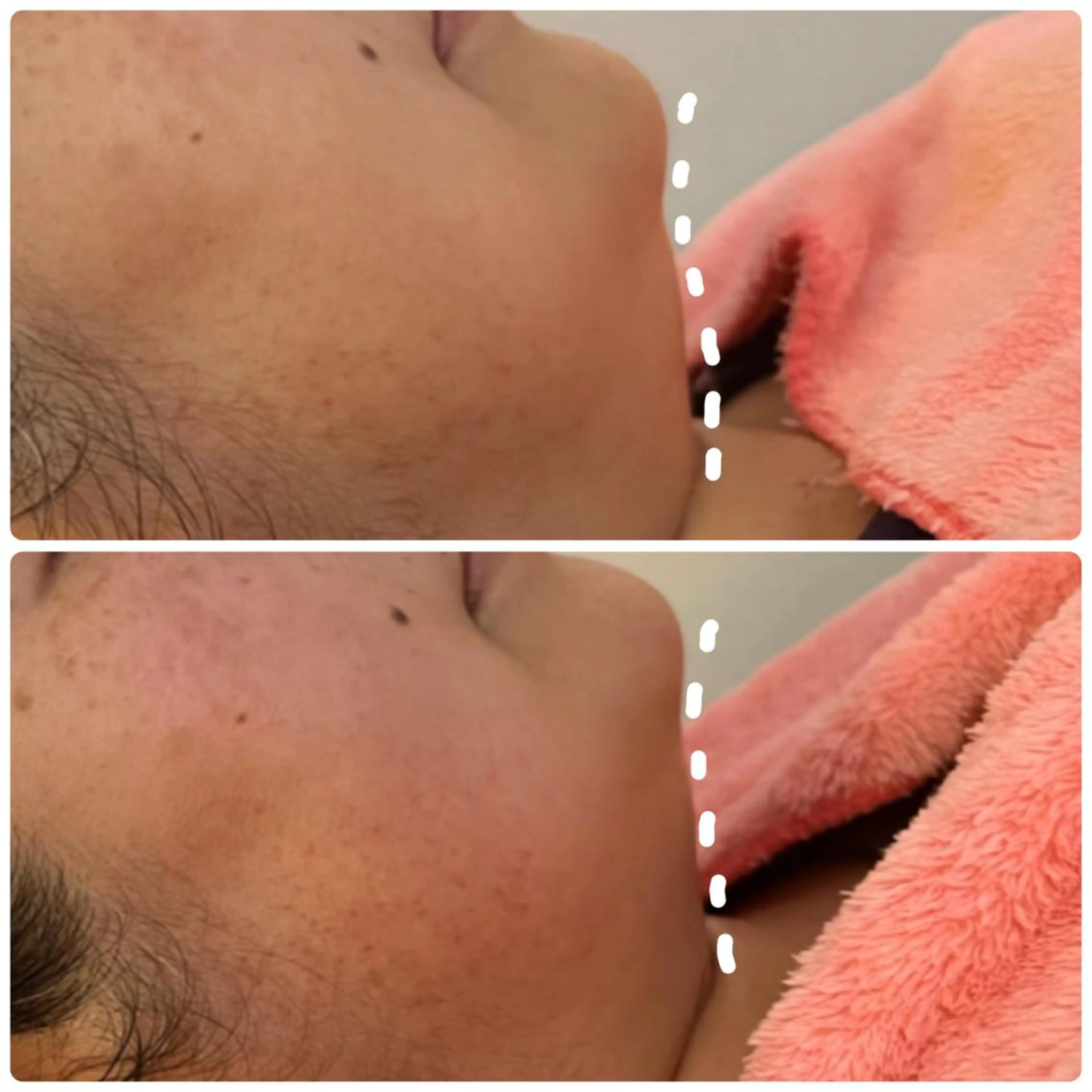 美肌/小顔/眉毛の 専門店 ルミナスのマツエク・マツパデザイン