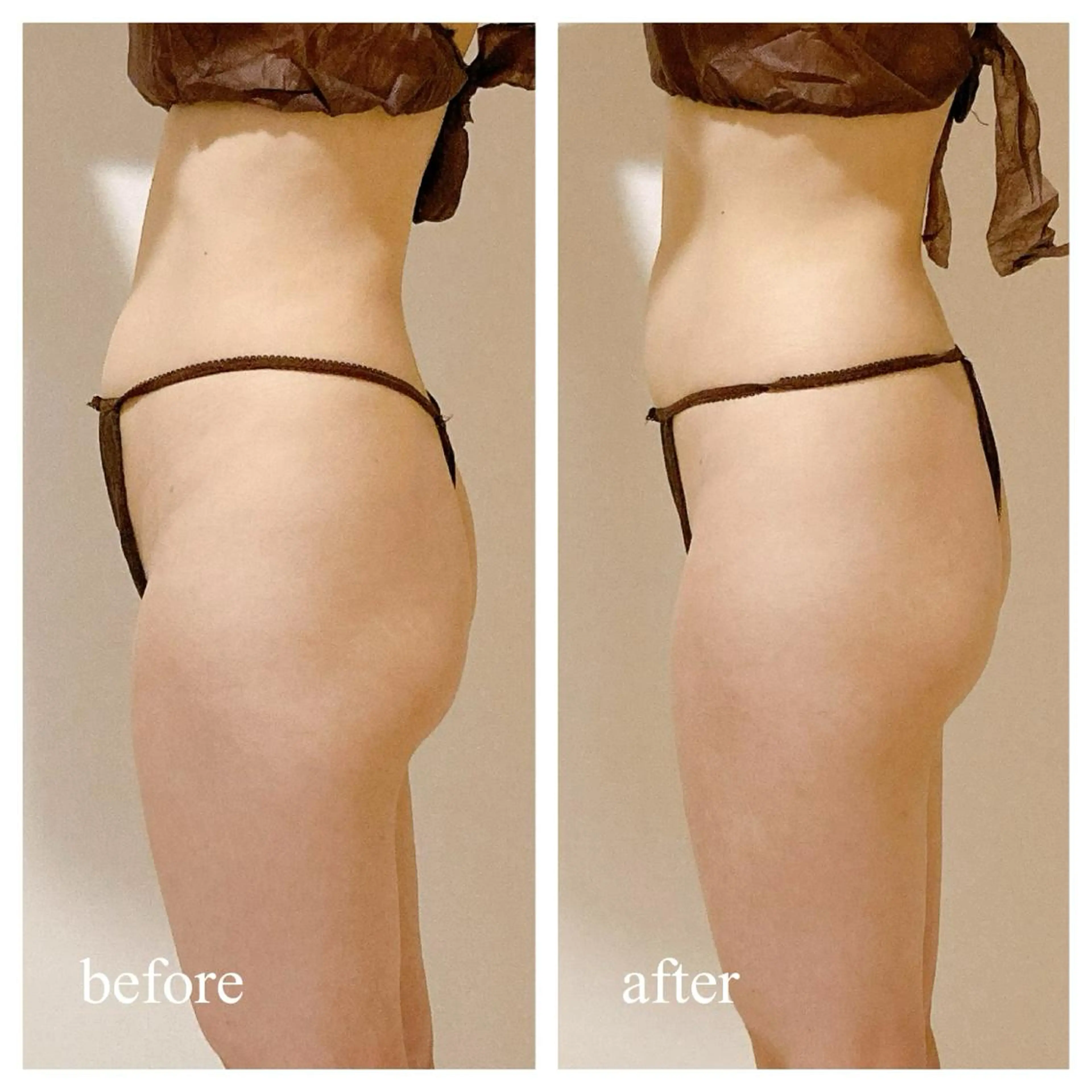 《姿勢改善・骨盤調整》美容整体40分【リニューアル特別価格✨】の写真