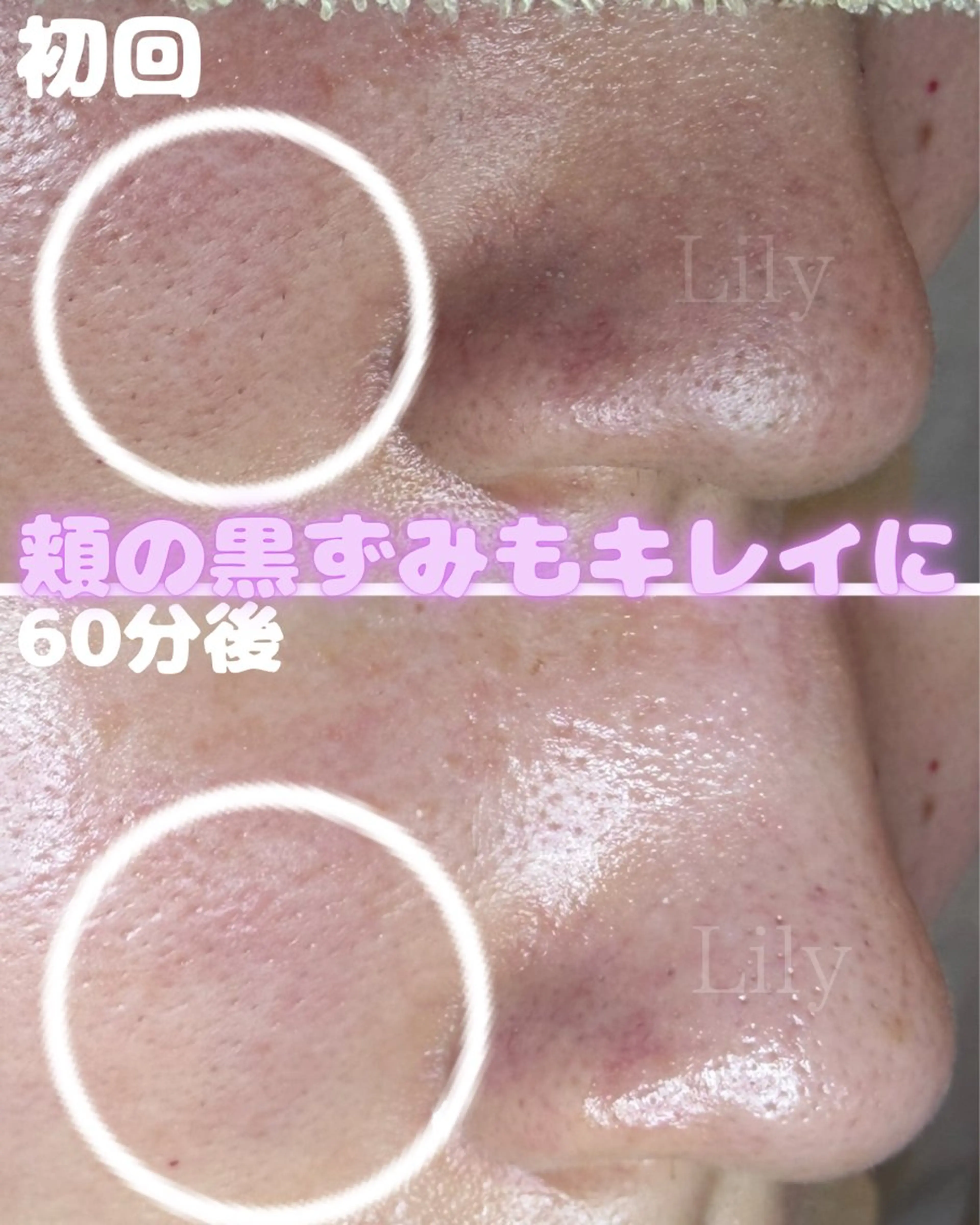 トータルビューティー サロンLilyのエステ・リラクイメージ