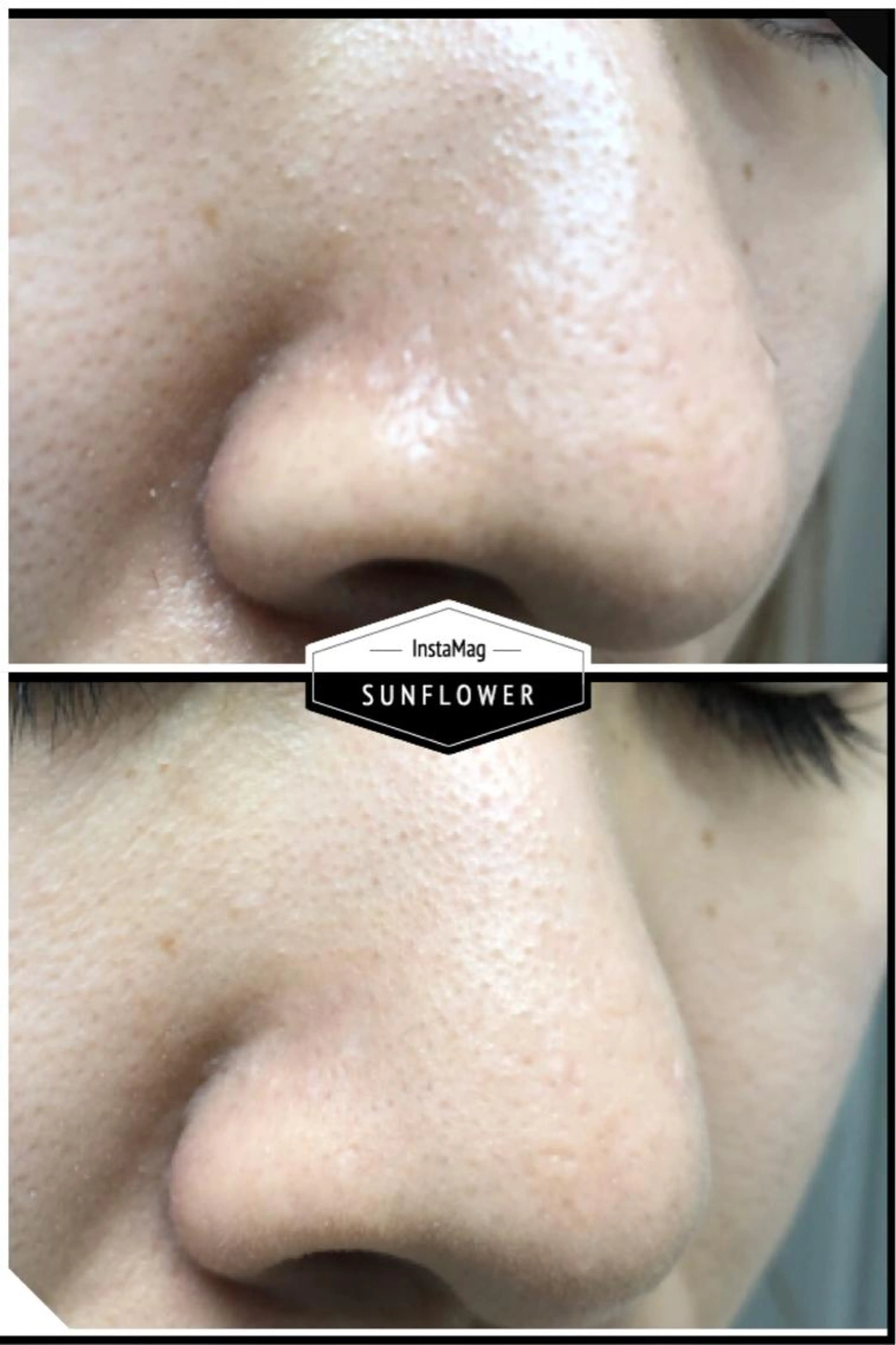 透明感が欲しい方へ🧡美白集中ケア✨の写真