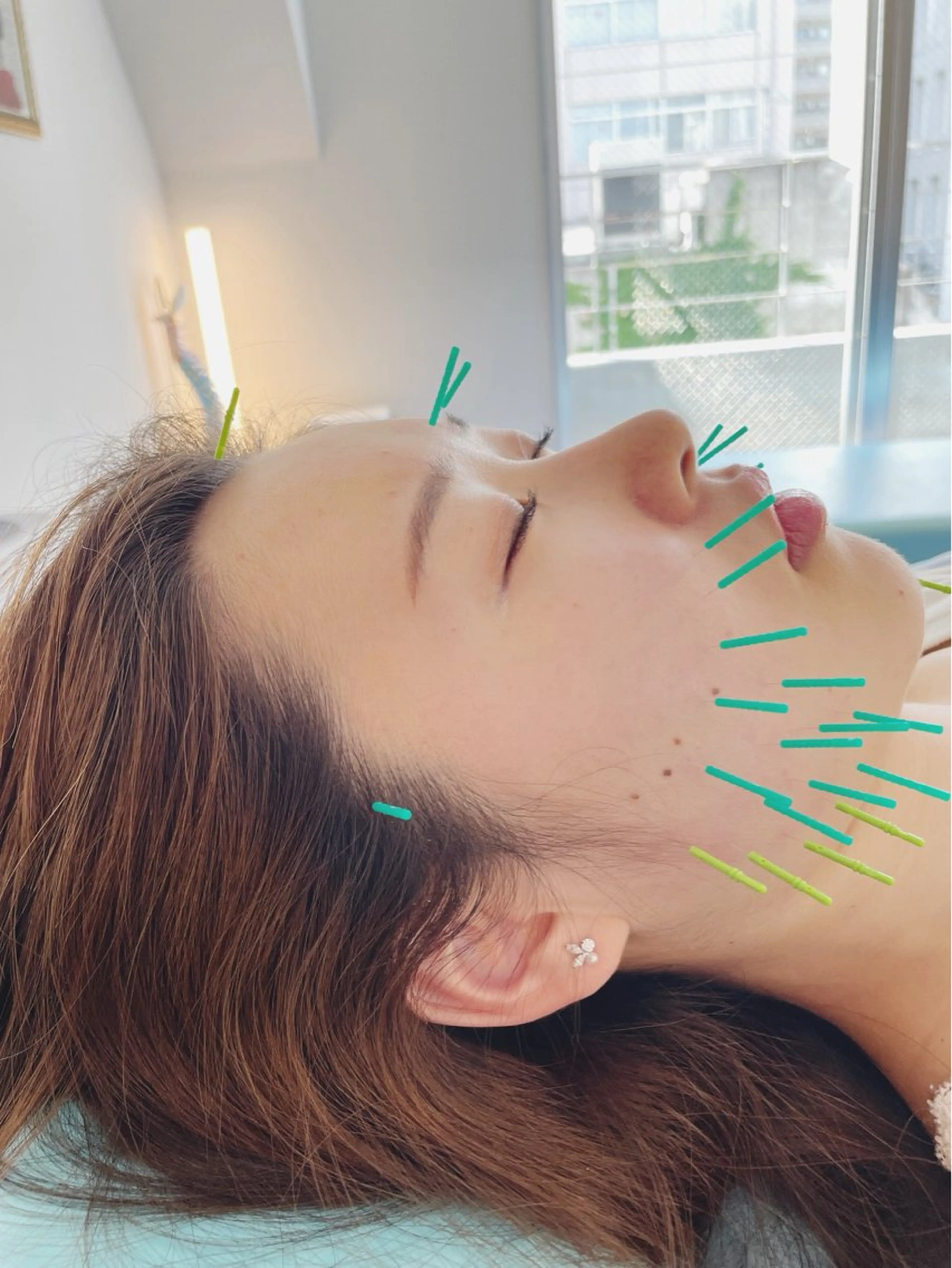 エステ リラク 小顔美容鍼専門サロン 渋谷YZのエステ・リラクイメージ