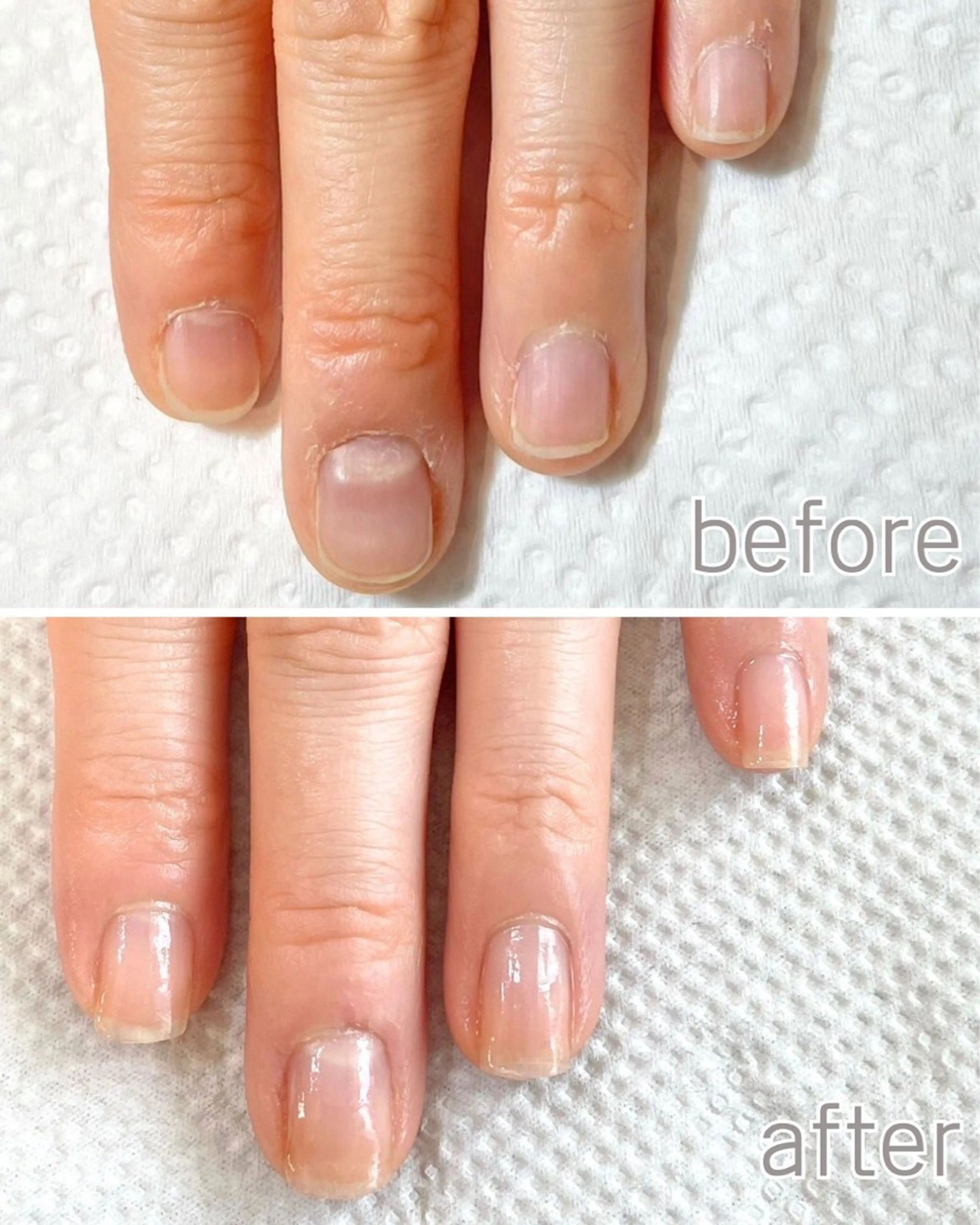 自爪育成《最強のネイルケア3ヶ月コース》モニター募集〇〇育成ネイルケア8回分/育成専用ホームケアセット込の写真