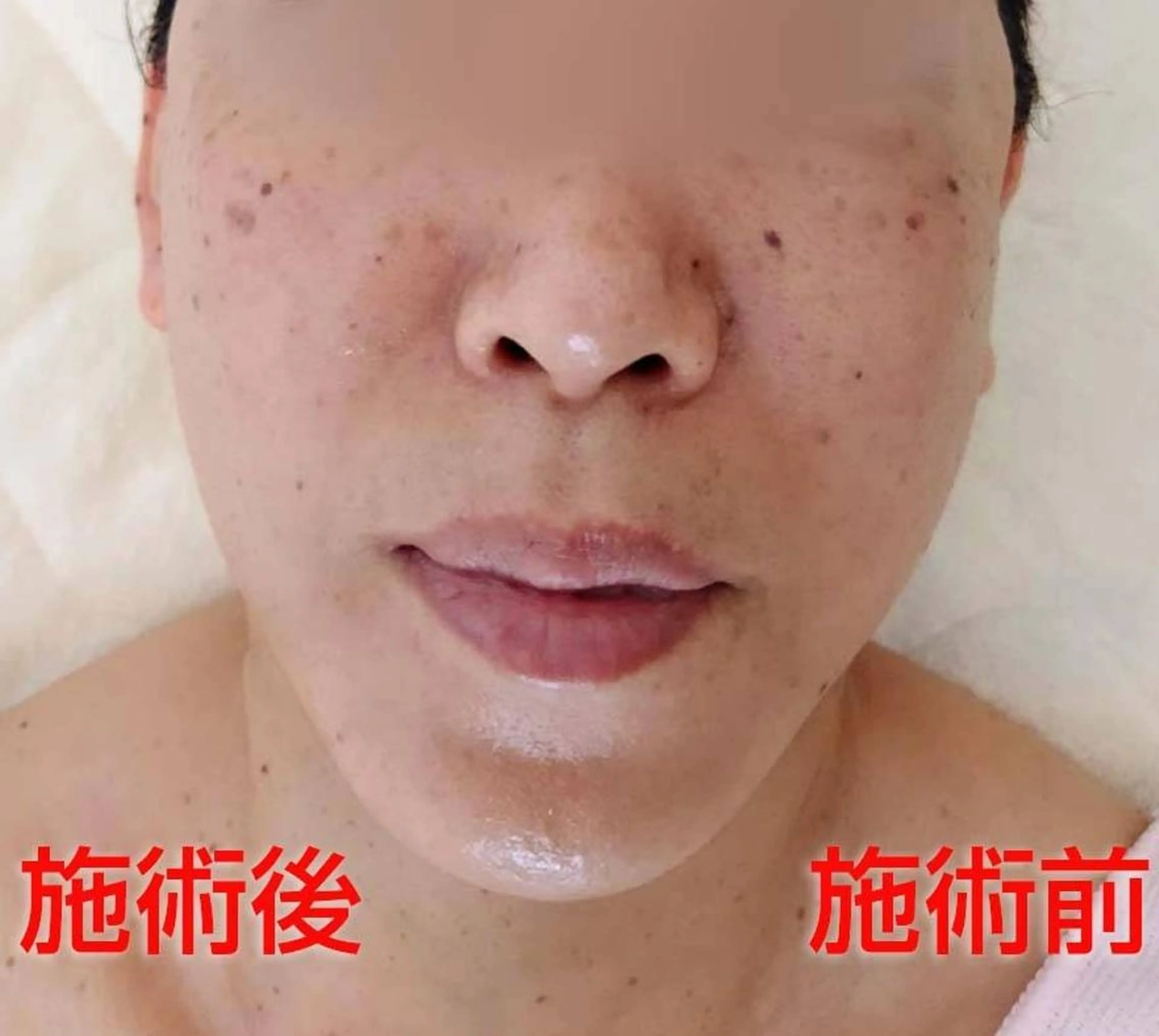 MAXまつ毛&  フェイシャルのマツエク・マツパデザイン