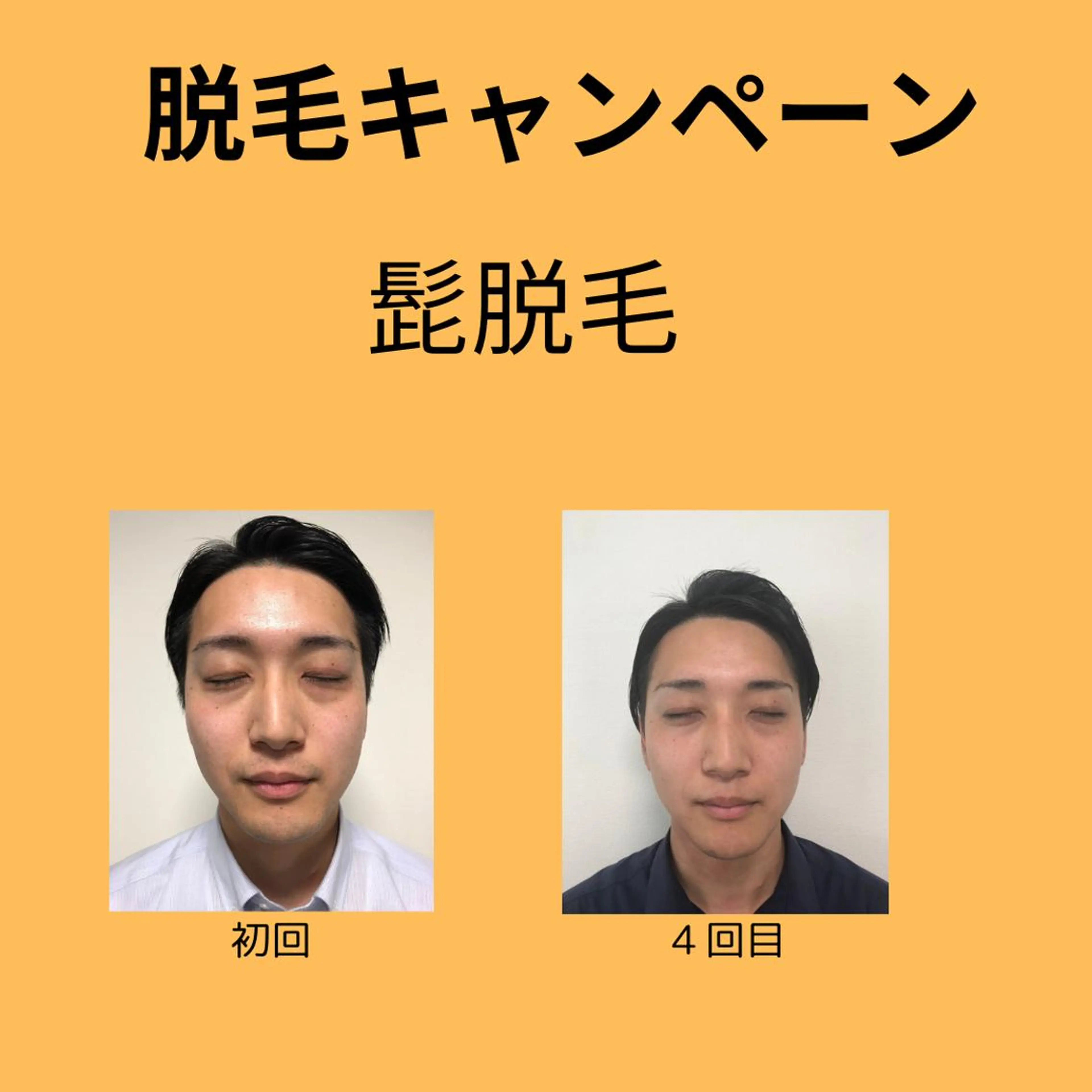 脱毛 Lien オーナー　山口智嘉のエステ・リラクイメージ