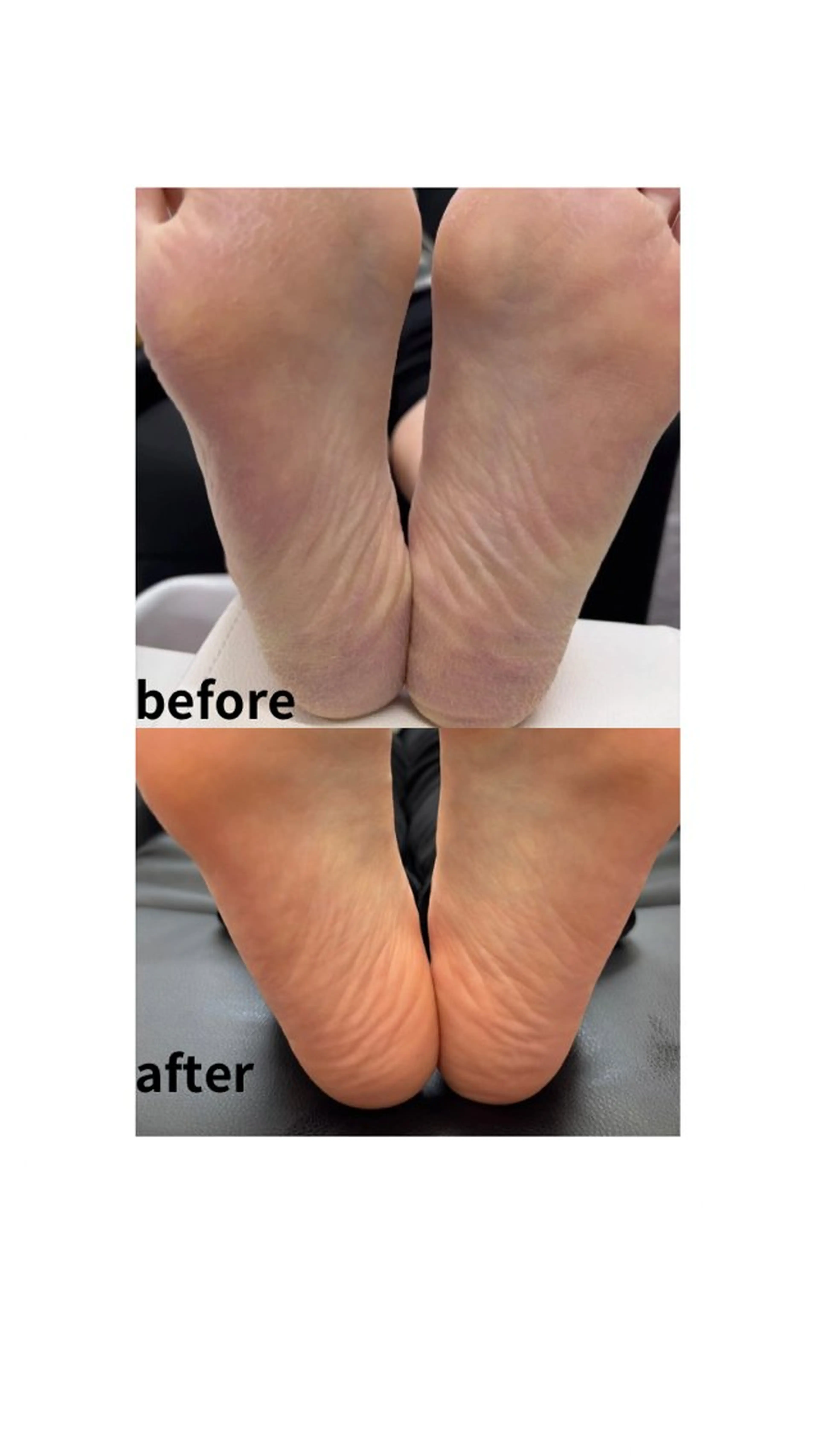 サンダルの時期にオススメフットケア👣❣️の写真