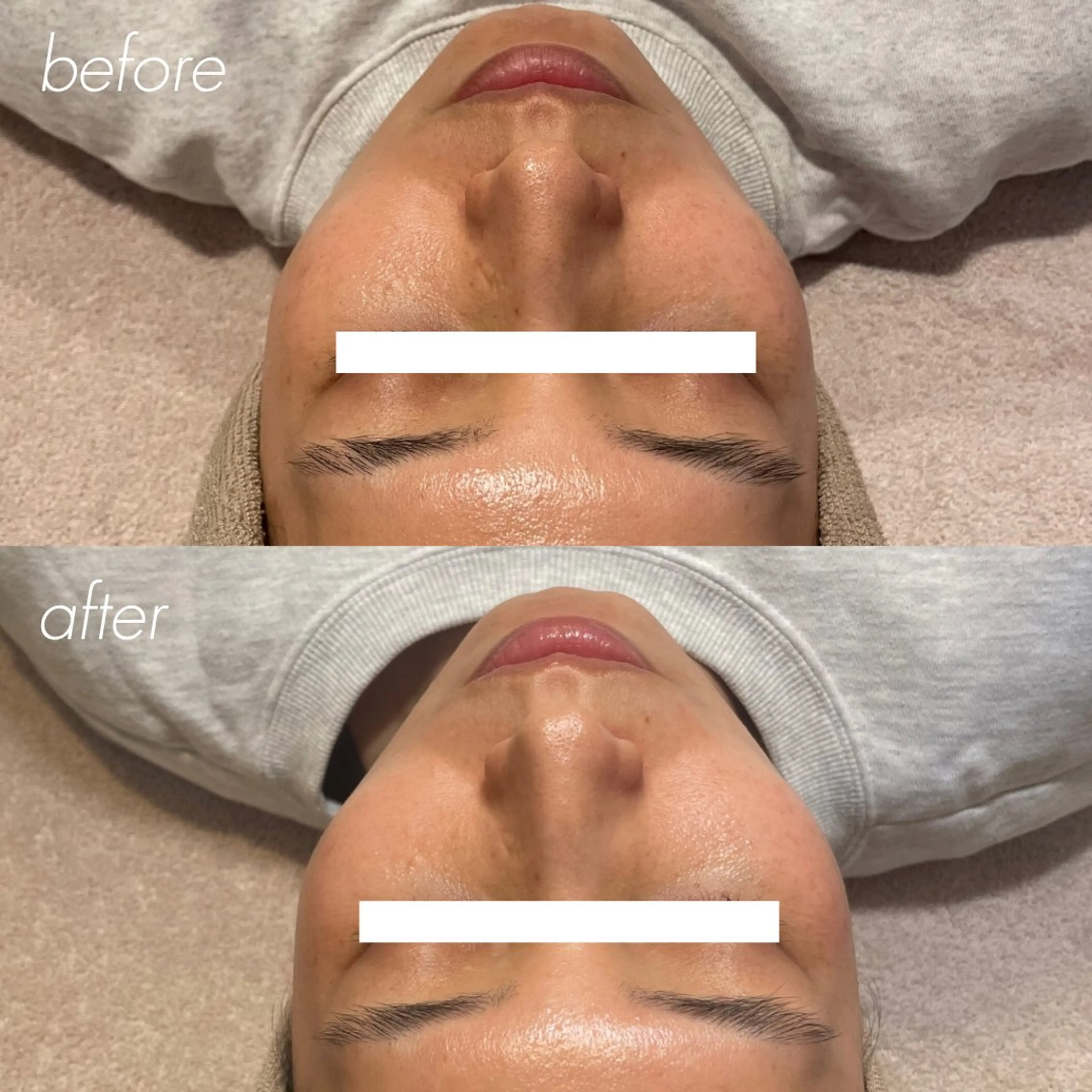 エステ Lassy Yuriの眉毛・アイブロウイメージ