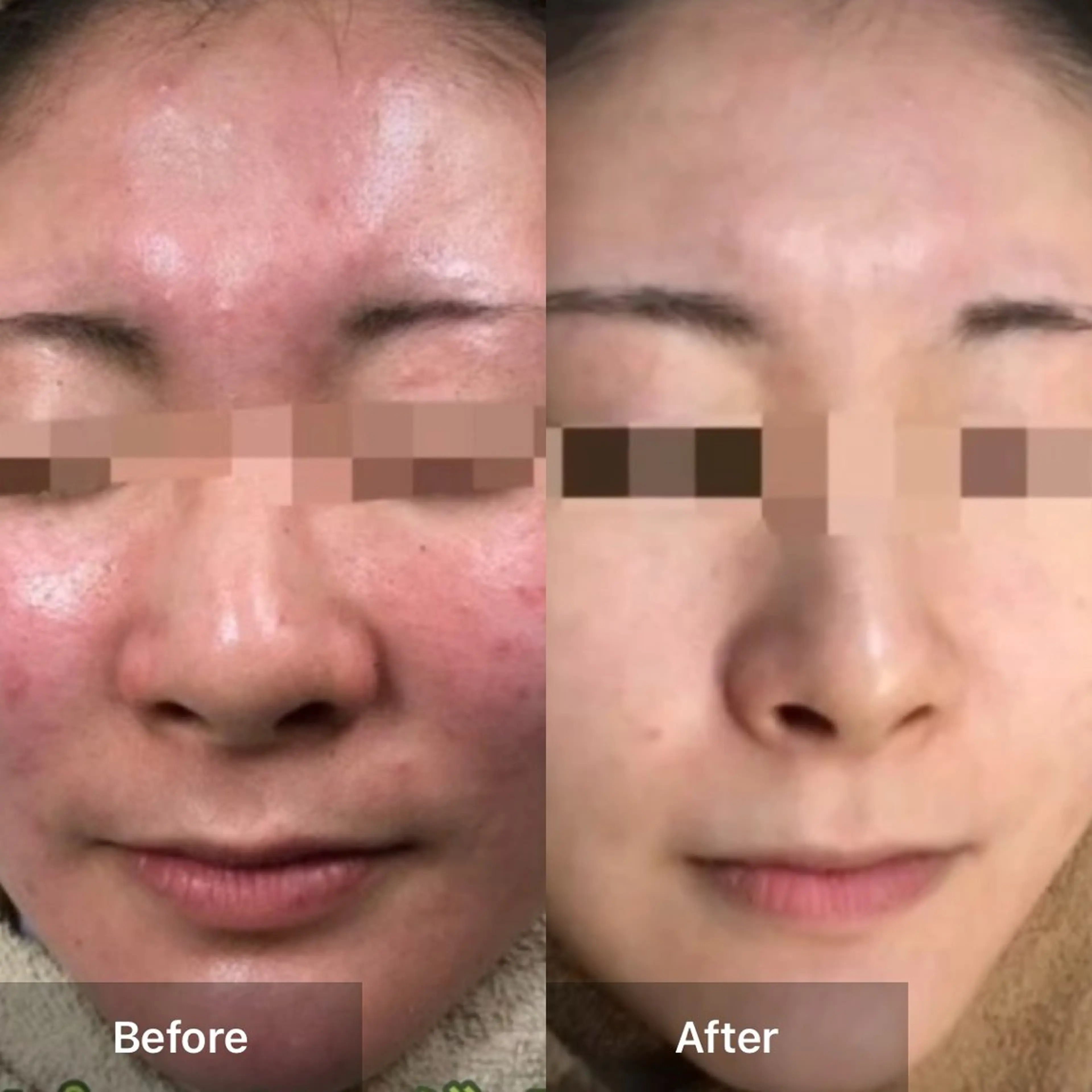 エステ ハーブピーリング 専門店MOKA所属・ハーブピーリング専門 MOKAのエステ・リラクイメージ