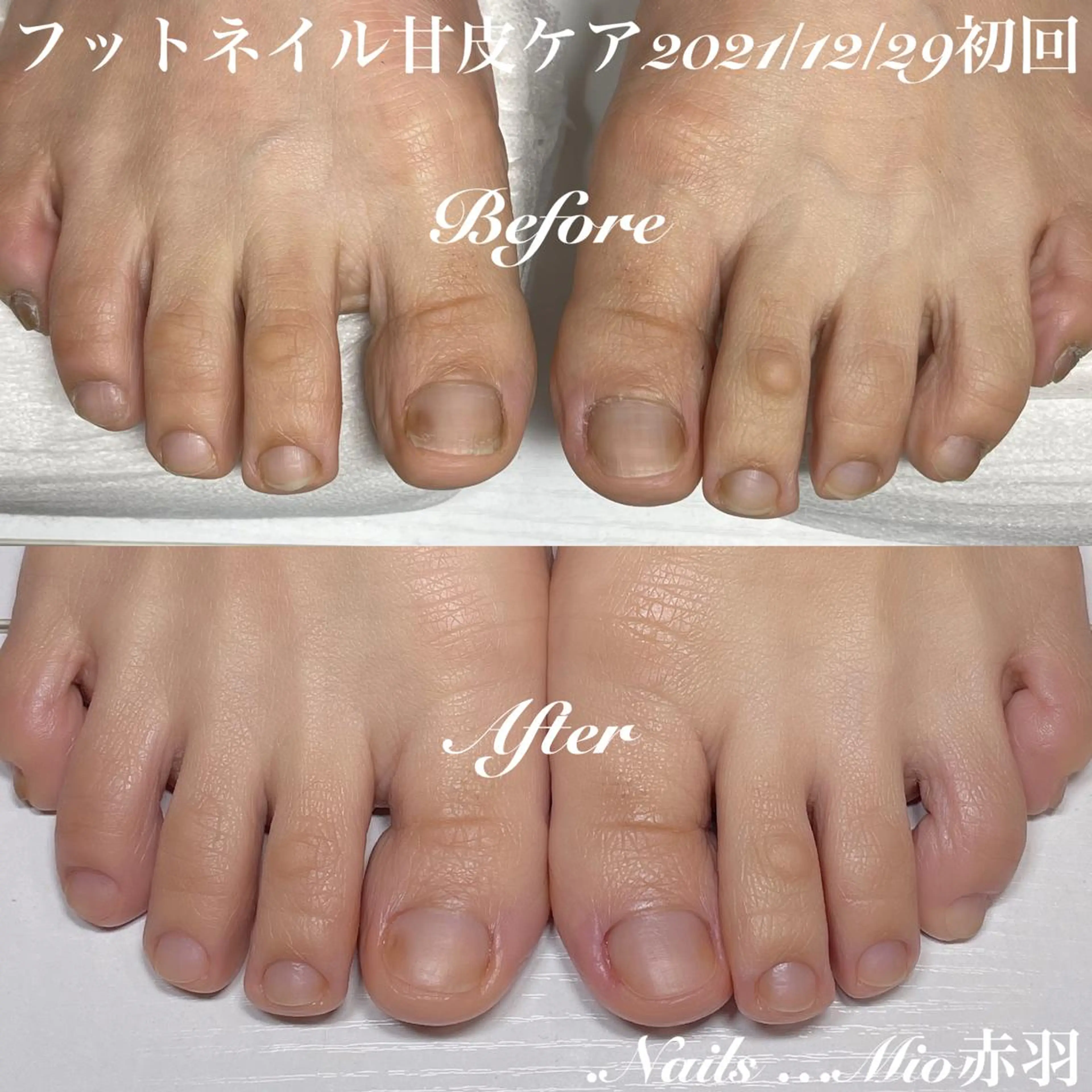 ネイル フットネイル .Nails Mio 赤羽西ネイルサロンのネイルデザイン