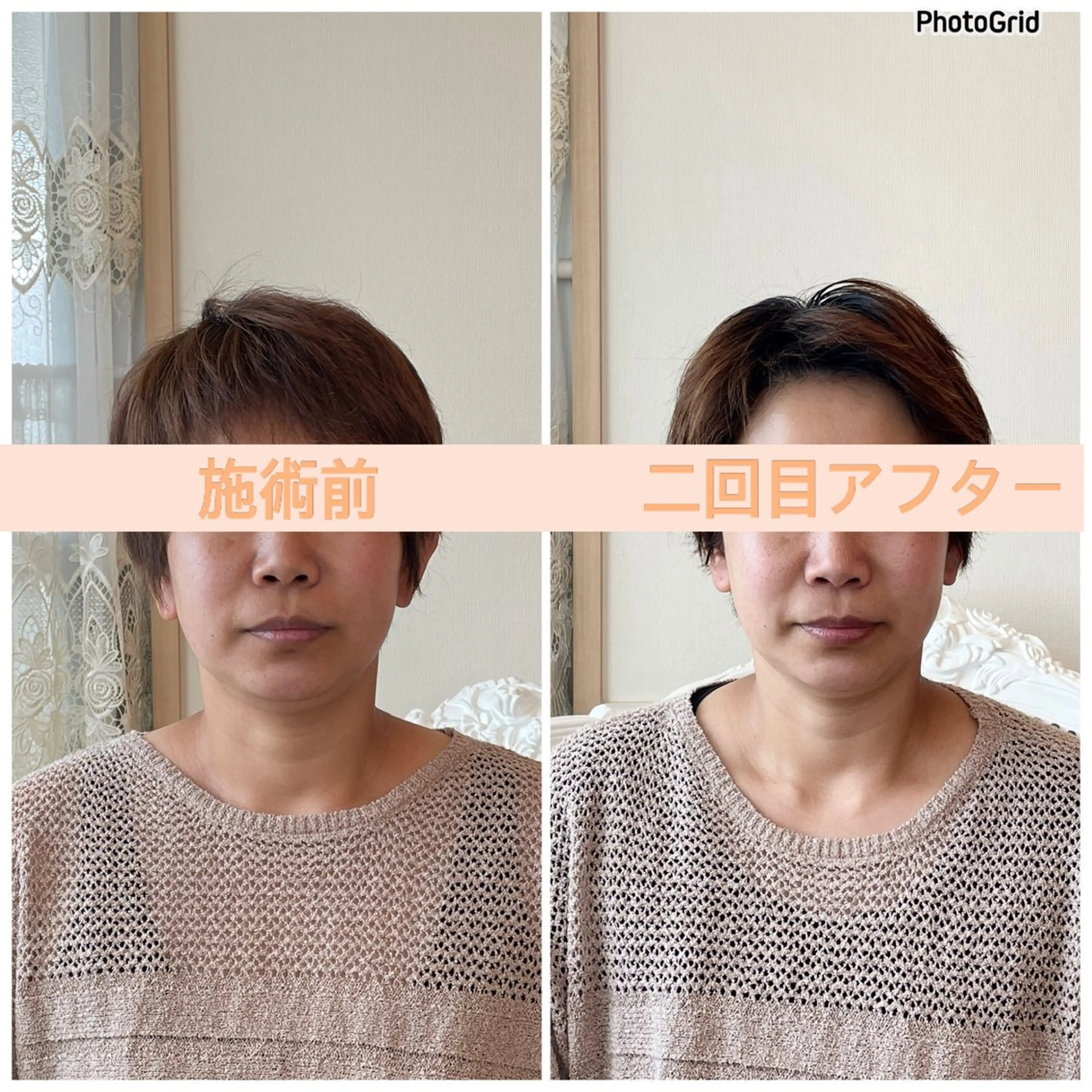 小顔矯正サロン　ReFace Fusae（リフェイスフサエ）所属・小顔矯正サロン リフェイスフサエのエステ・リラクイメージ