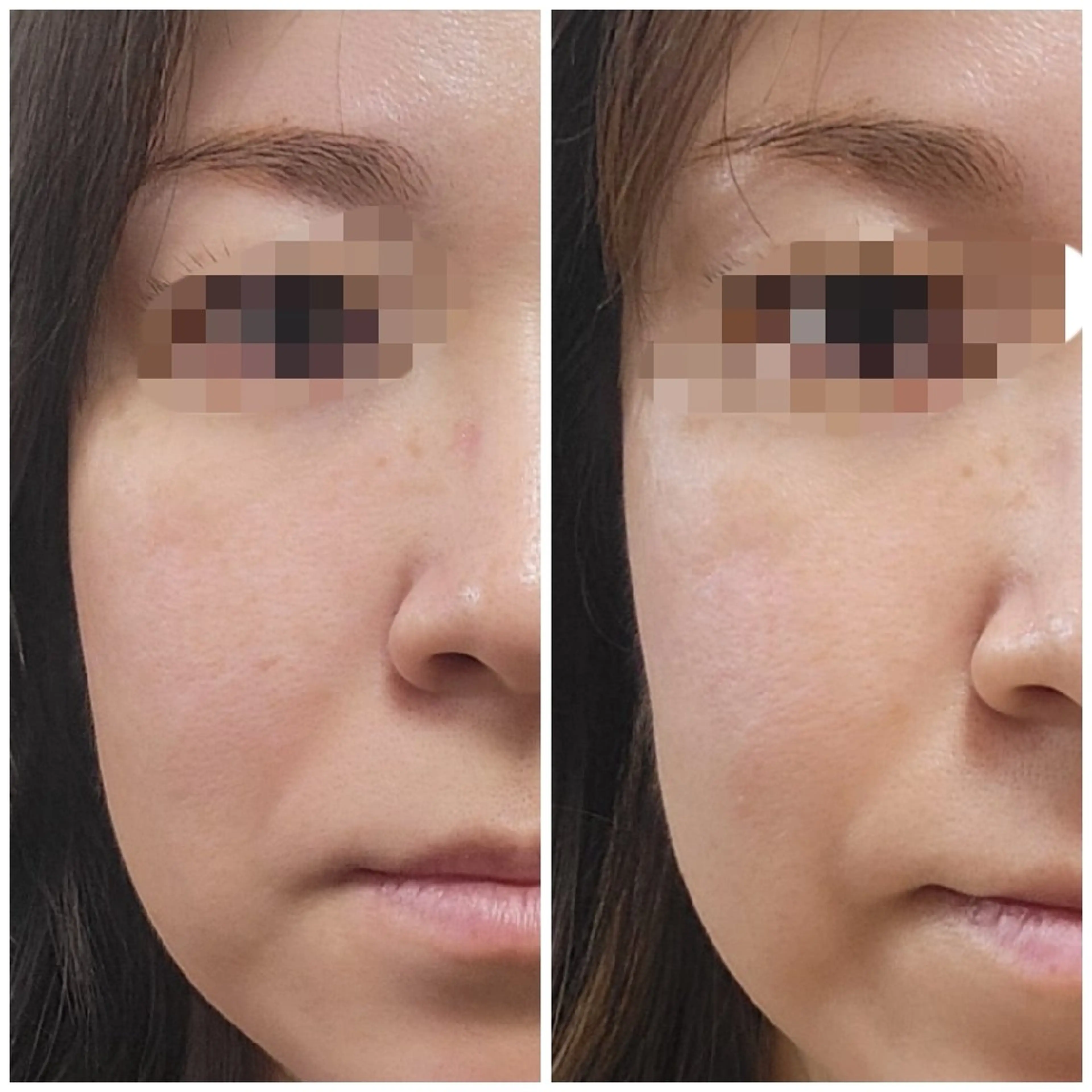 エステ RYO  八尾市の眉毛・アイブロウイメージ