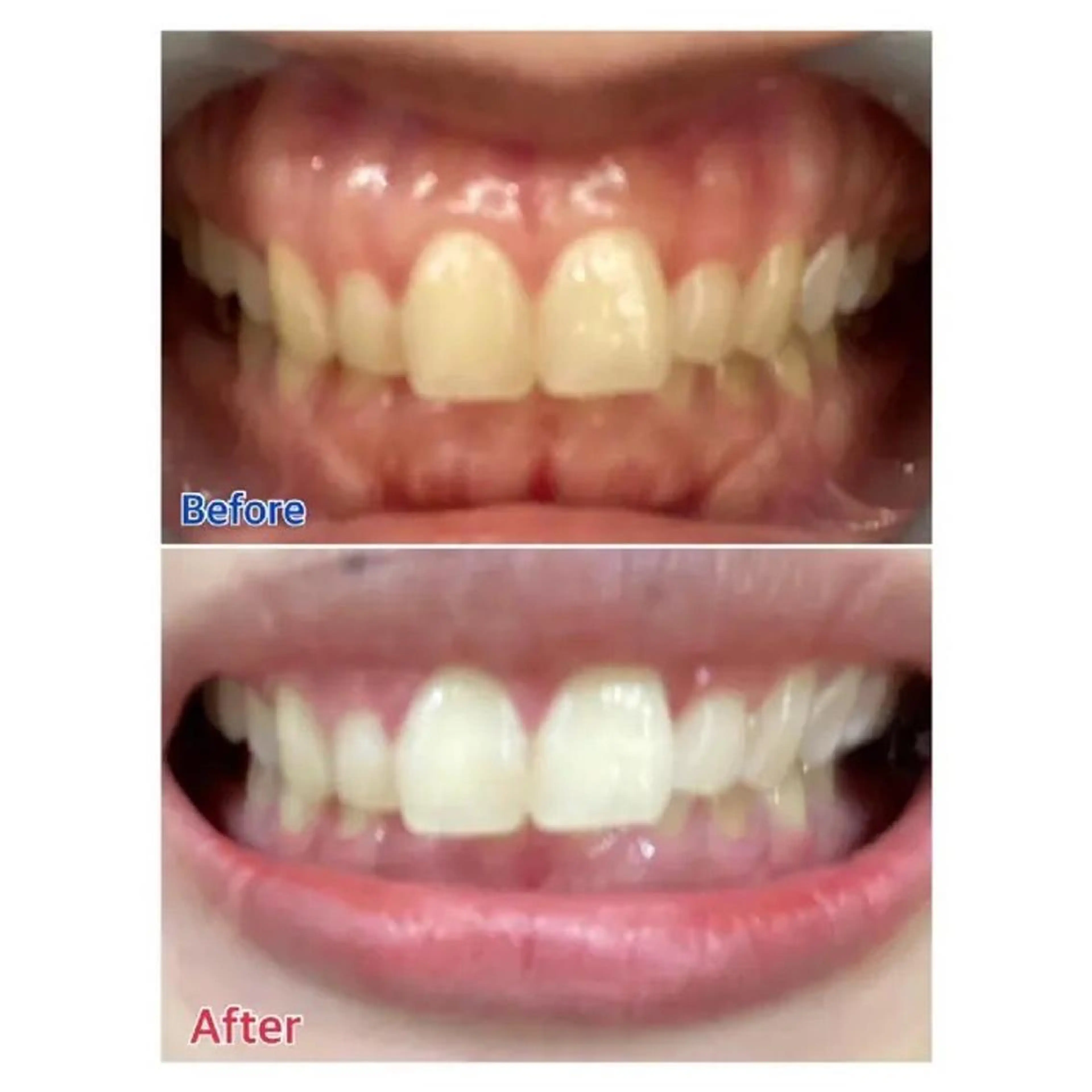 M渋谷店所属・Ｍ渋谷 ホワイトニングのエステ・リラクイメージ