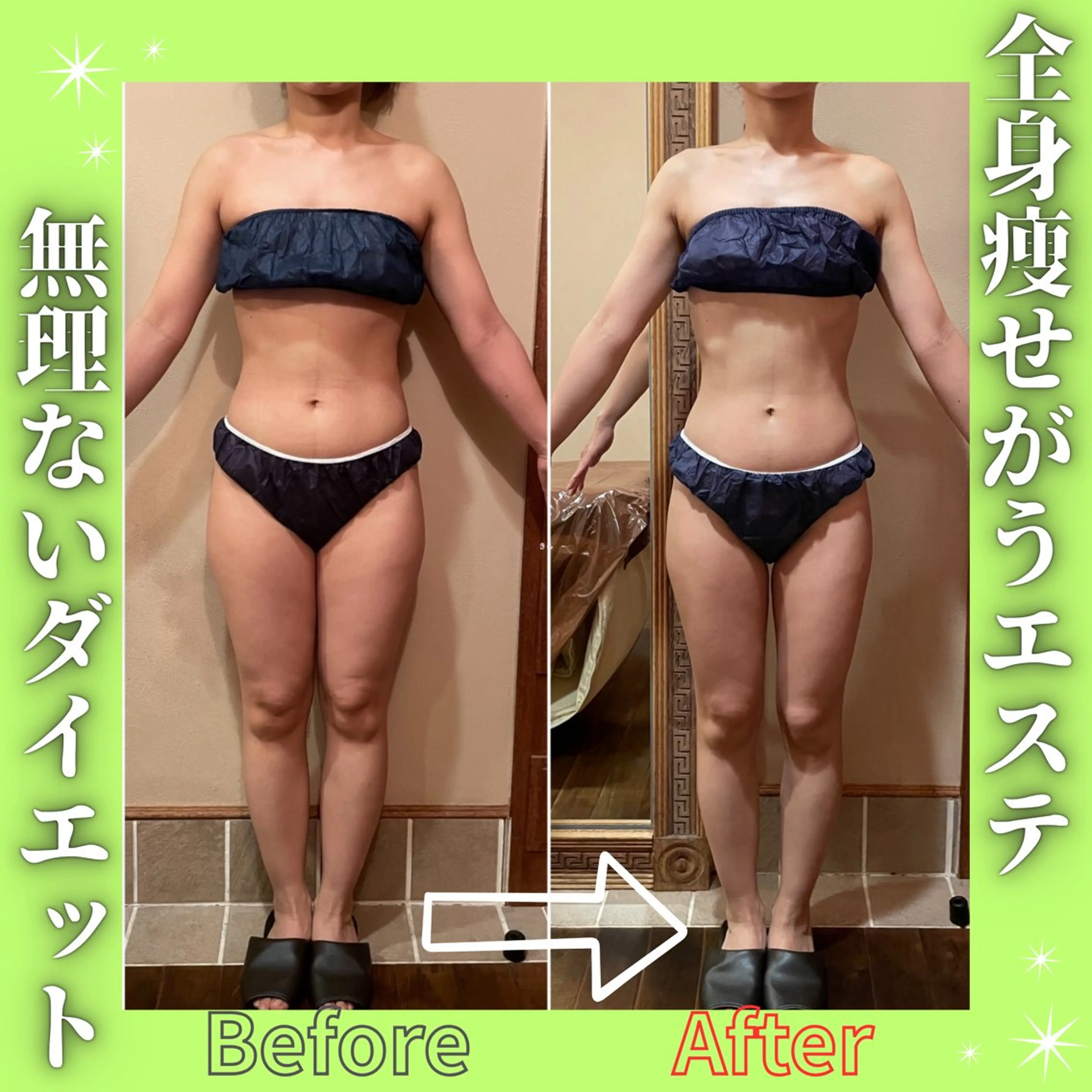 【韓国アイドル級美脚🦵】下半身痩せ🫧インディバ越え筋膜リリース90分˗ˋ꒰♥꒱ˊ˗の写真