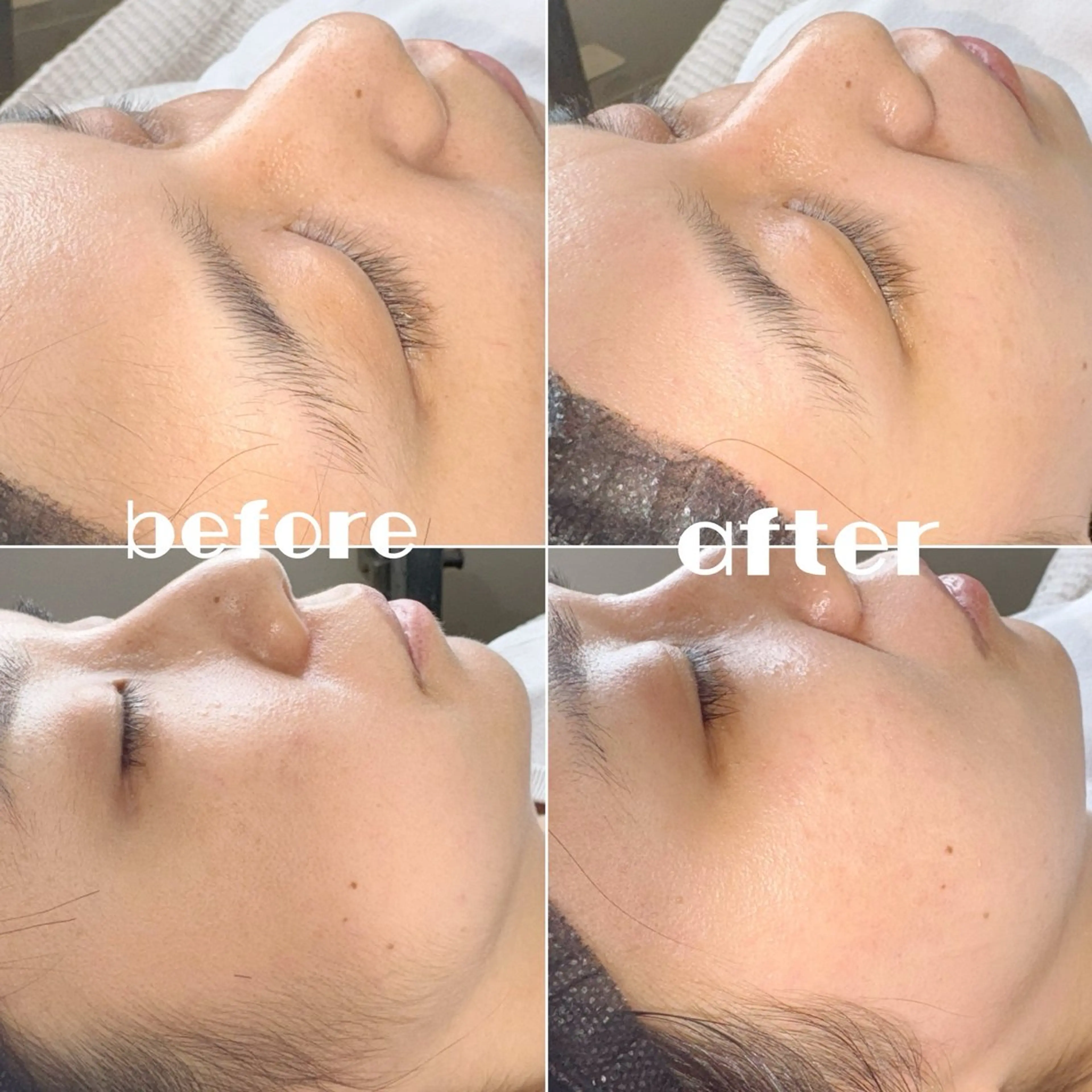 美眉スタイリング（眉毛ワックス）＋艶肌フェイスワックス（全顔）の写真