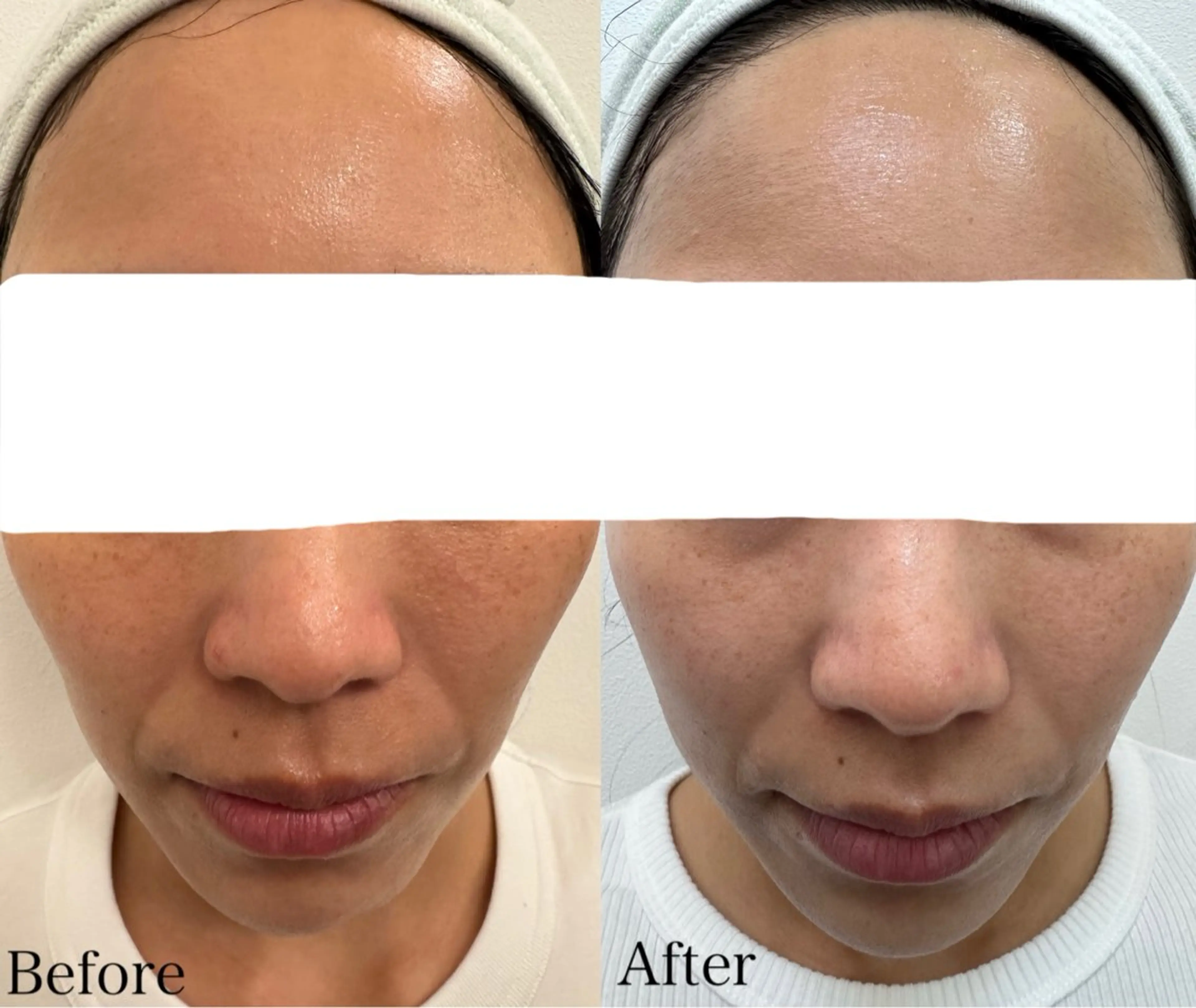 beautysalon LIMOA所属・松本 愛絵理のエステ・リラクイメージ