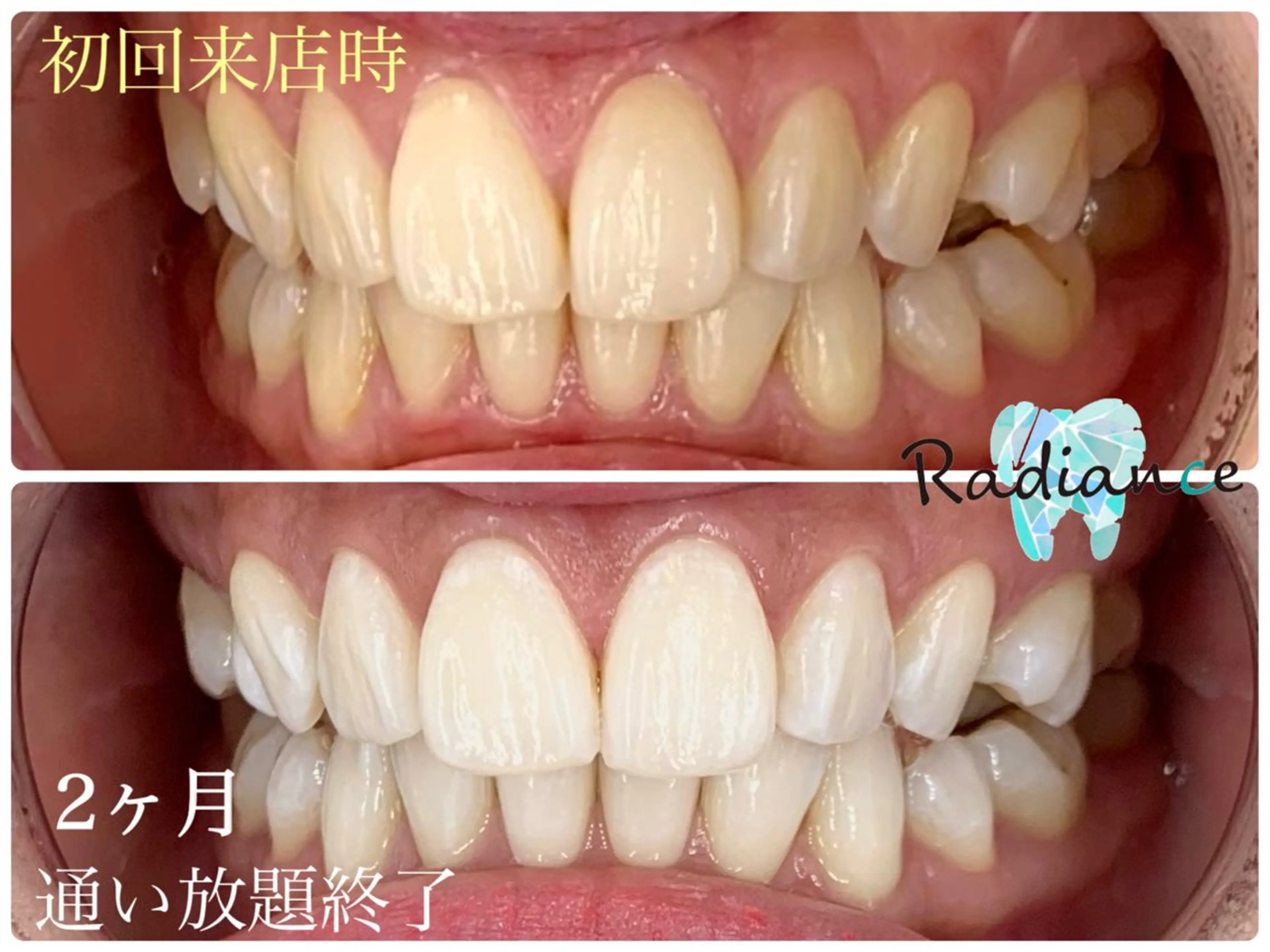 その他 札幌ホワイトニング ラディアンス札幌駅店のその他イメージ