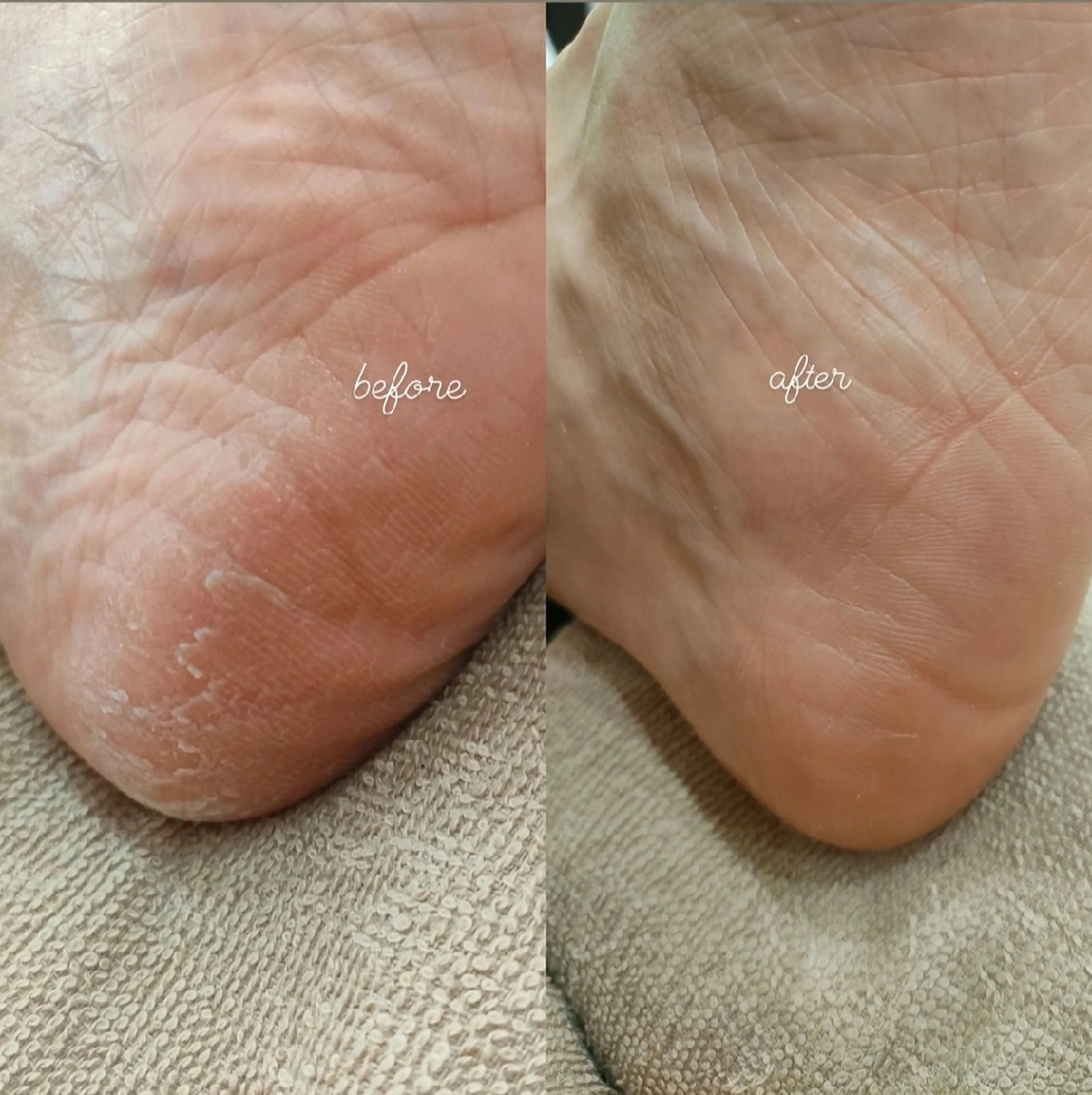 ネイル フットネイル douceknail所属・本厚木南口 徒歩3分のネイルデザイン