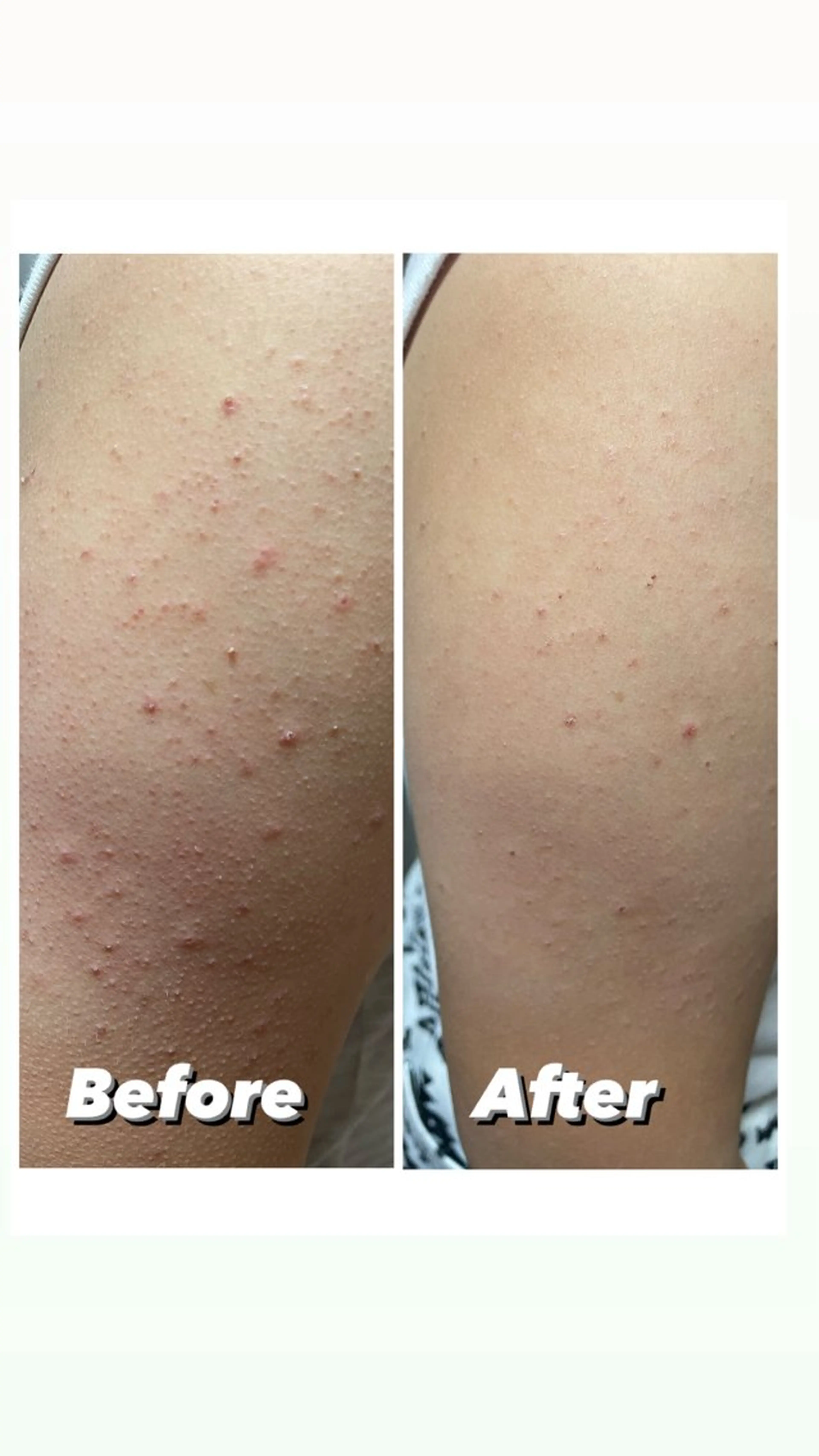 メンズ 韓国最先端技術サロン Luangeのエステ・リラクイメージ