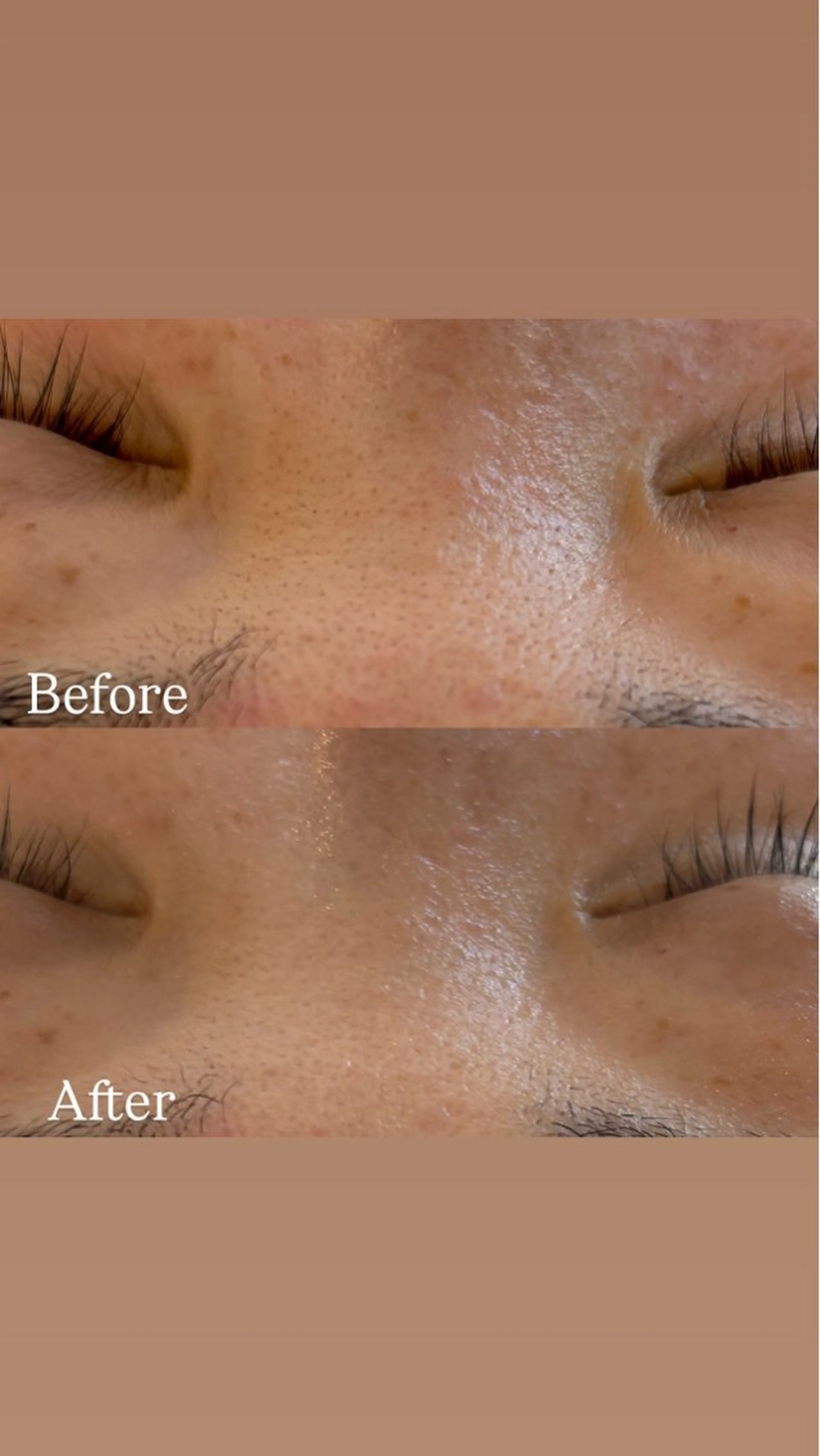 エステ Del'm豊橋所属・豊橋De'Im 安部のエステ・リラクイメージ