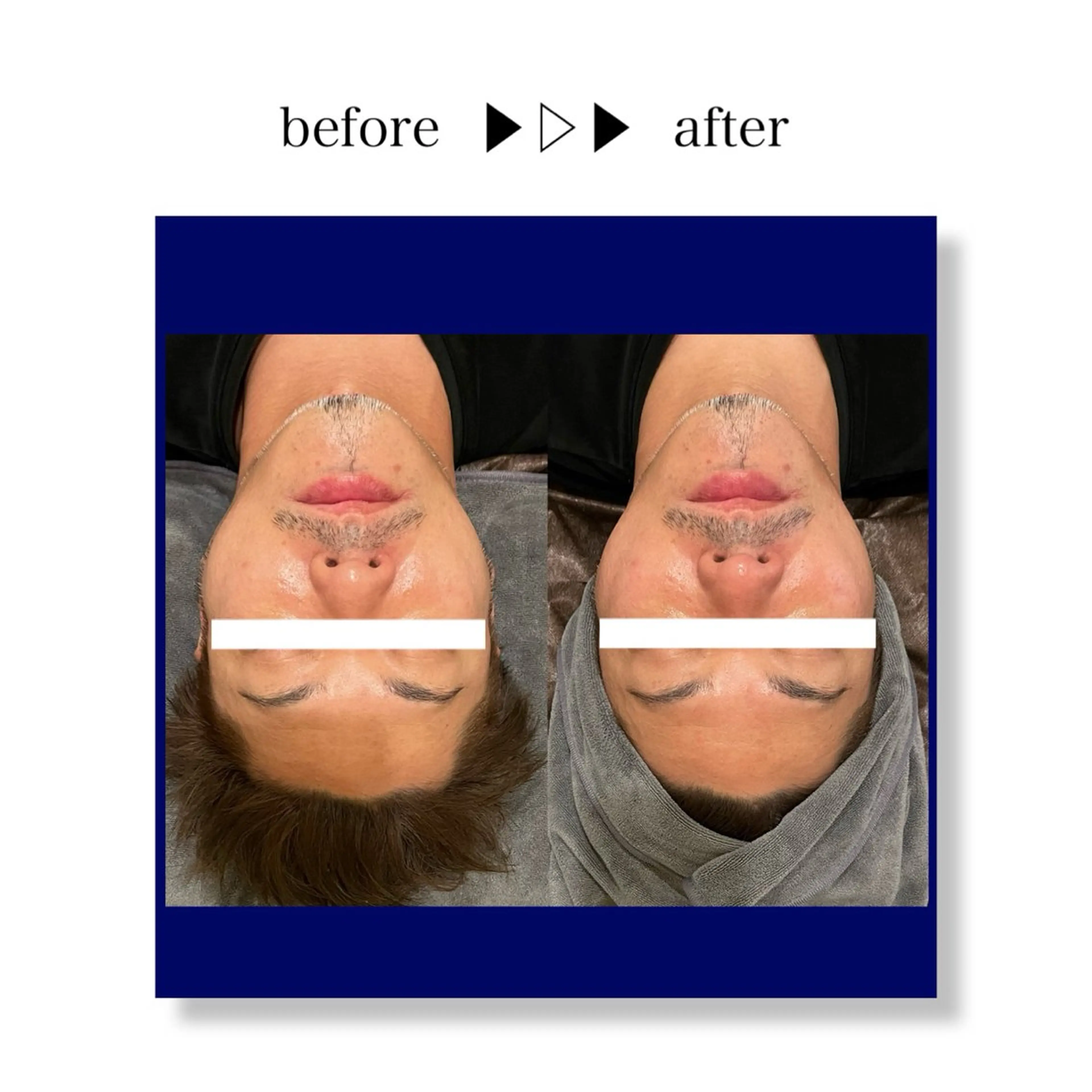 ☆痩身/小顔☆ コルギのエステ・リラクイメージ