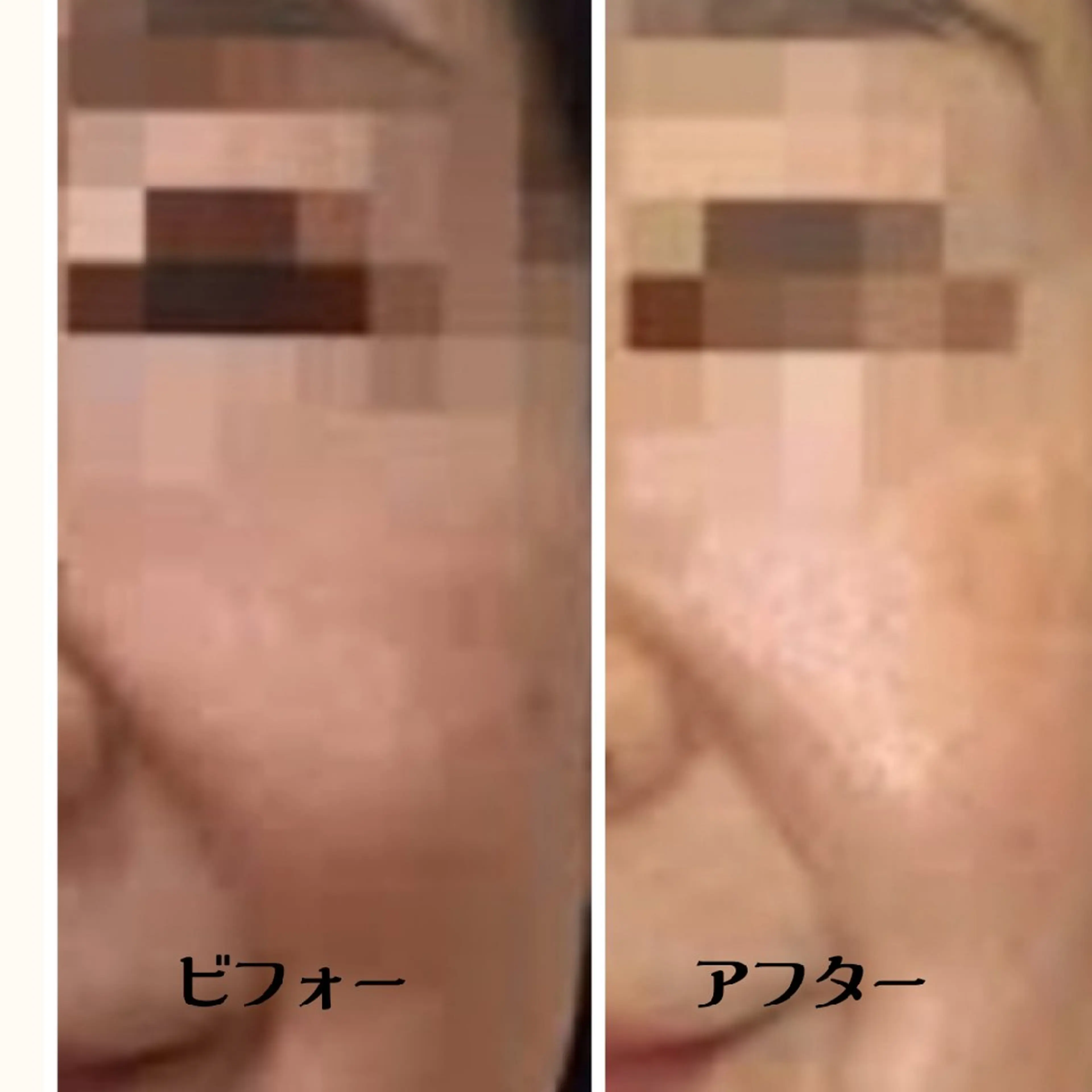 EL.ALLY イーエル.アリーのエステ・リラクイメージ