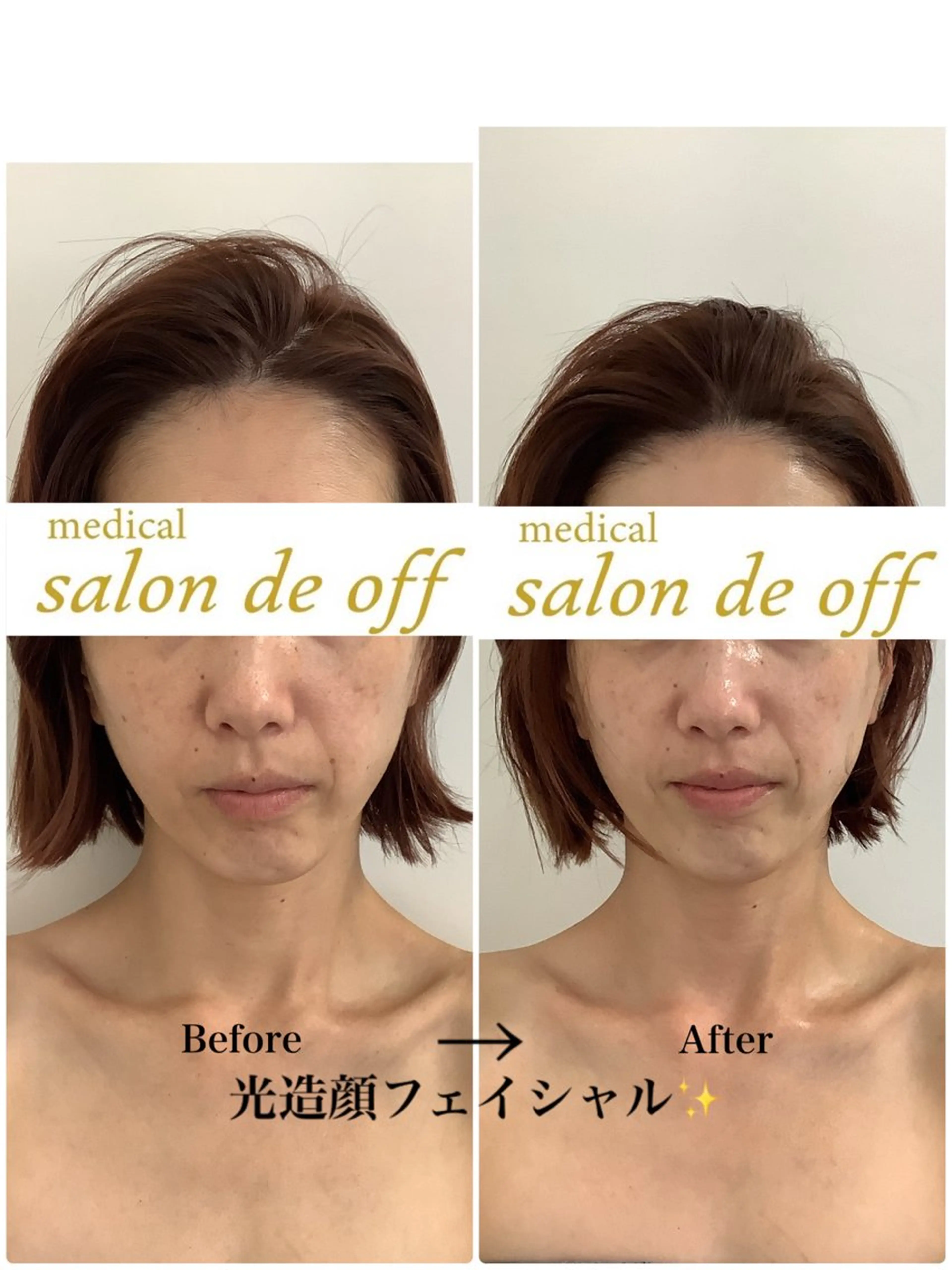 エステ リラク 🩵Tatsumi Kana🩵のエステ・リラクイメージ