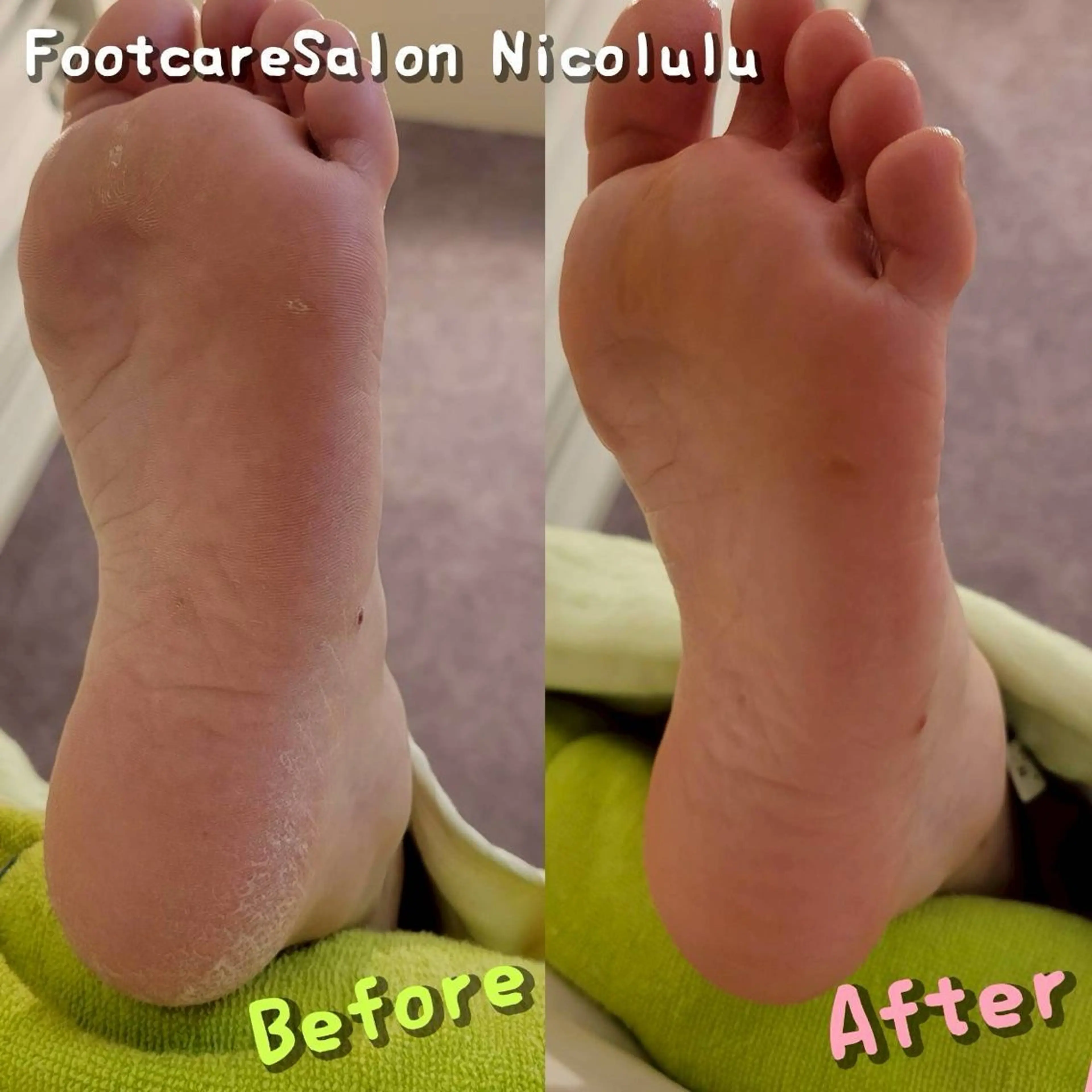 リラク 足トラブル専門 ニコルル金沢のエステ・リラクイメージ