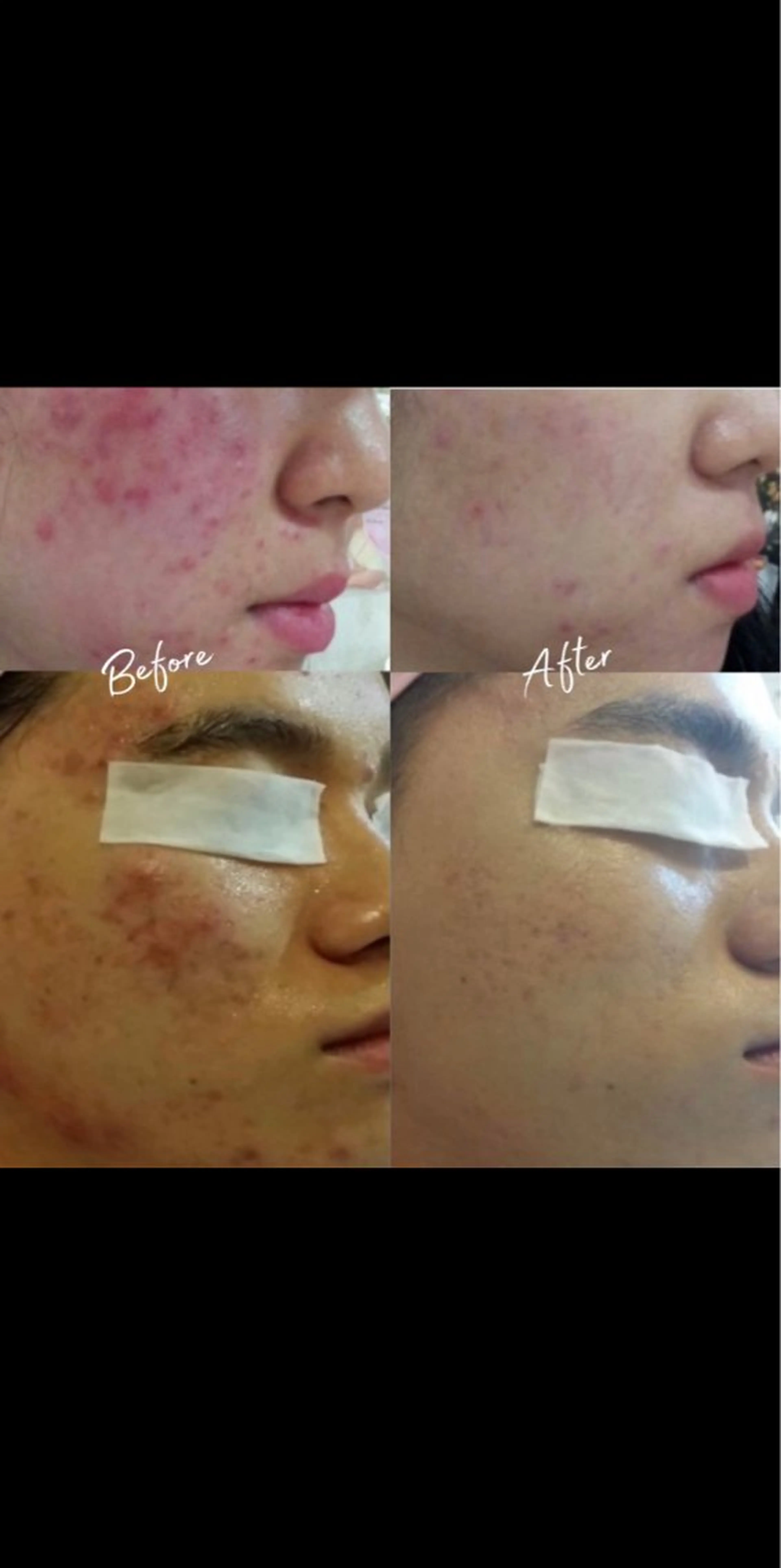 アンジェリック ビーナス　Rinonのエステ・リラクイメージ