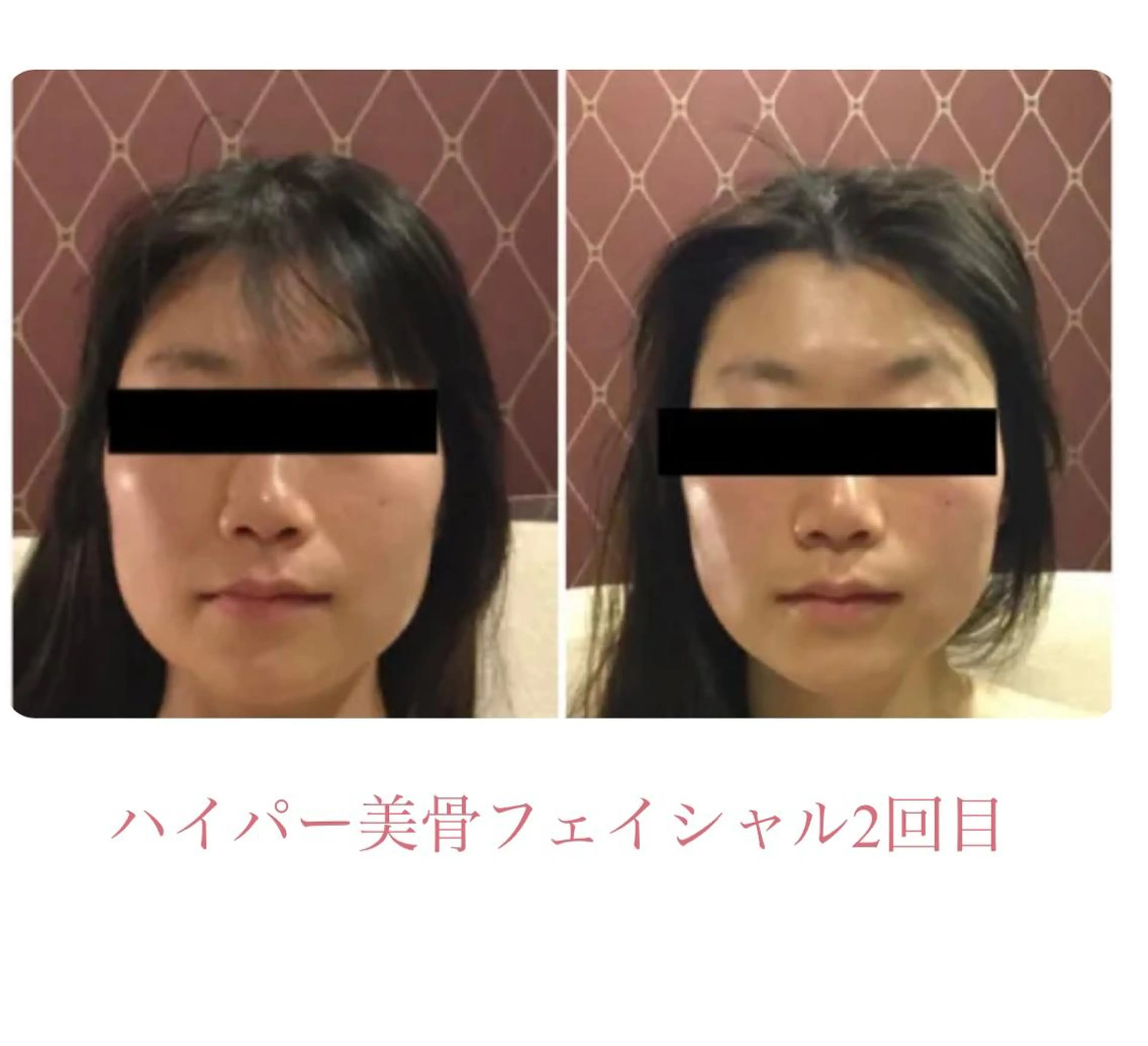 DEA  LUCE所属・痩身&小顔エステ DEA   LUCEのエステ・リラクイメージ