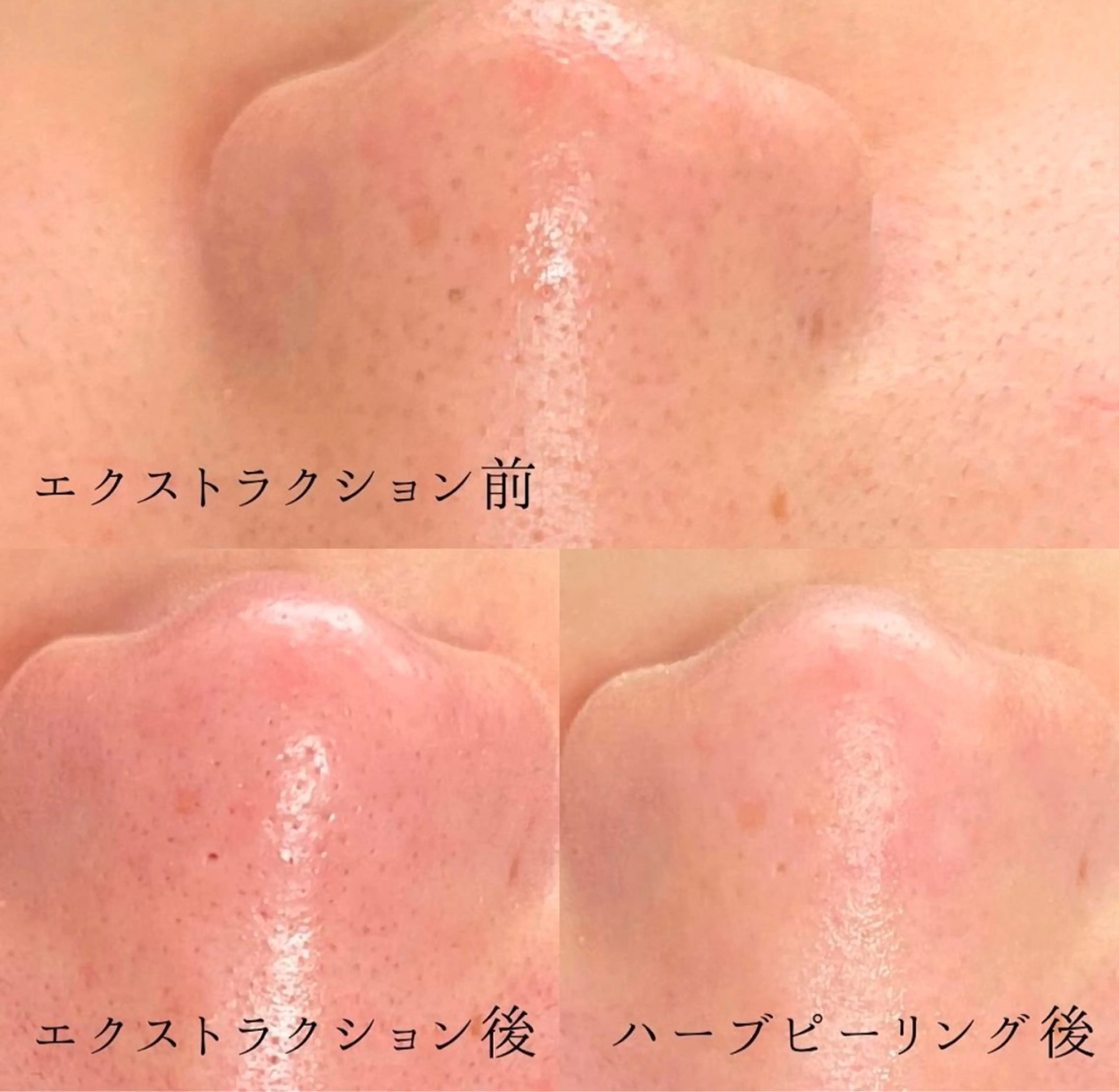 エステ リラク プライベートサロン emma【エマ】のその他イメージ