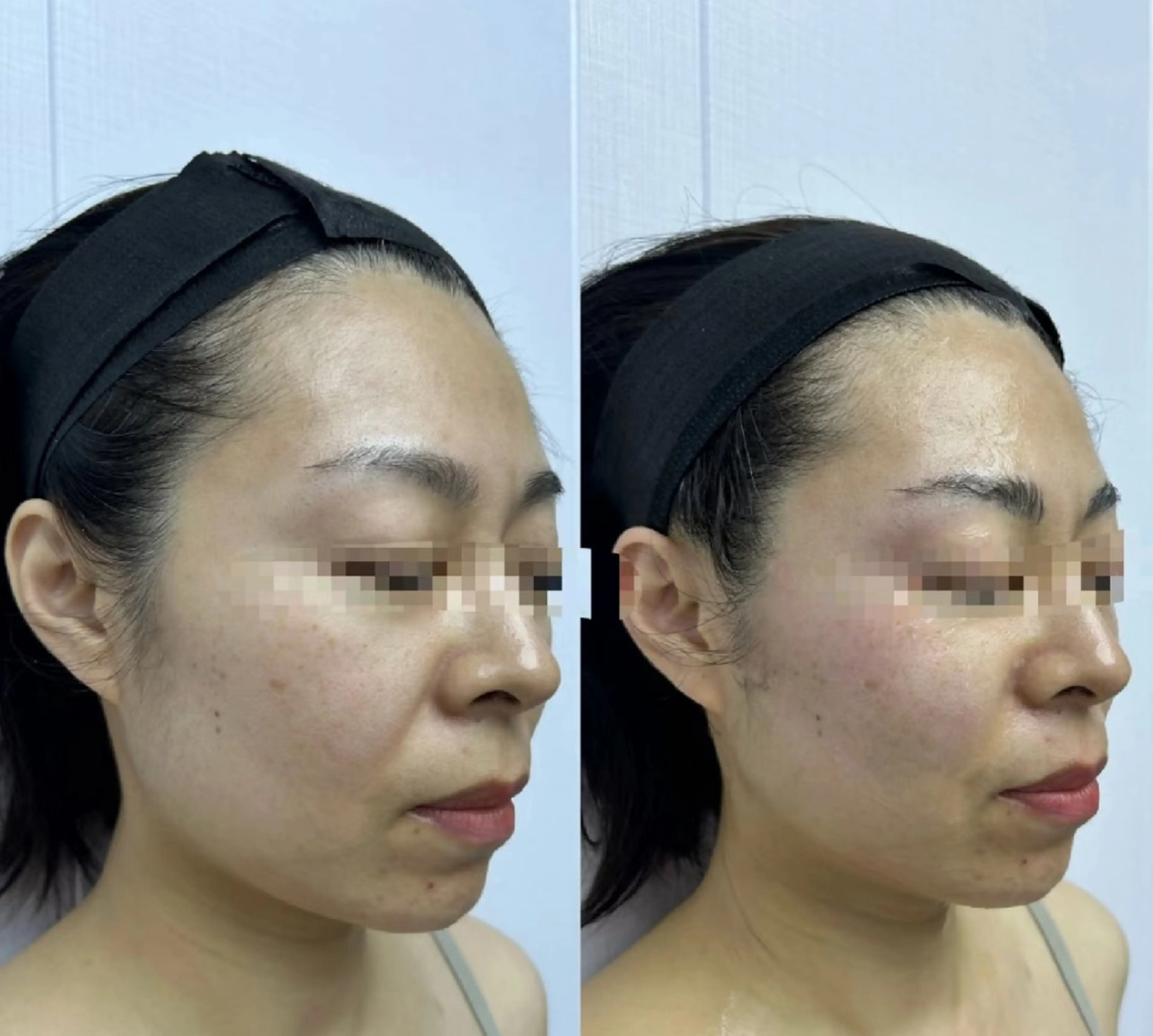 マツエク・マツパ 結婚式・ブライダル aliaハイフ&水光ジェットサロン所属・aliaハーブ水光店 エステティシャン募集のエステ・リラクイメージ